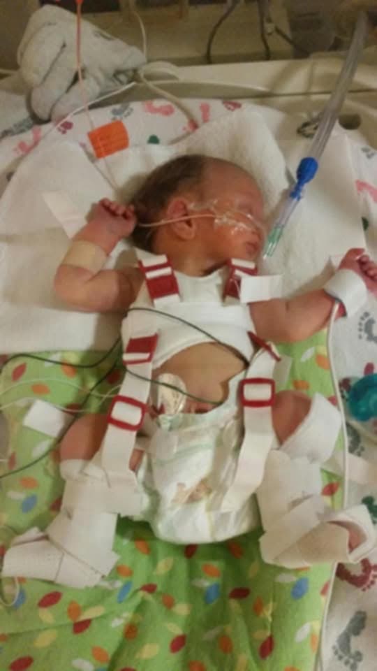 Support Hailey's Journey for Improved Quality of Life campaign photo, 2 of 8