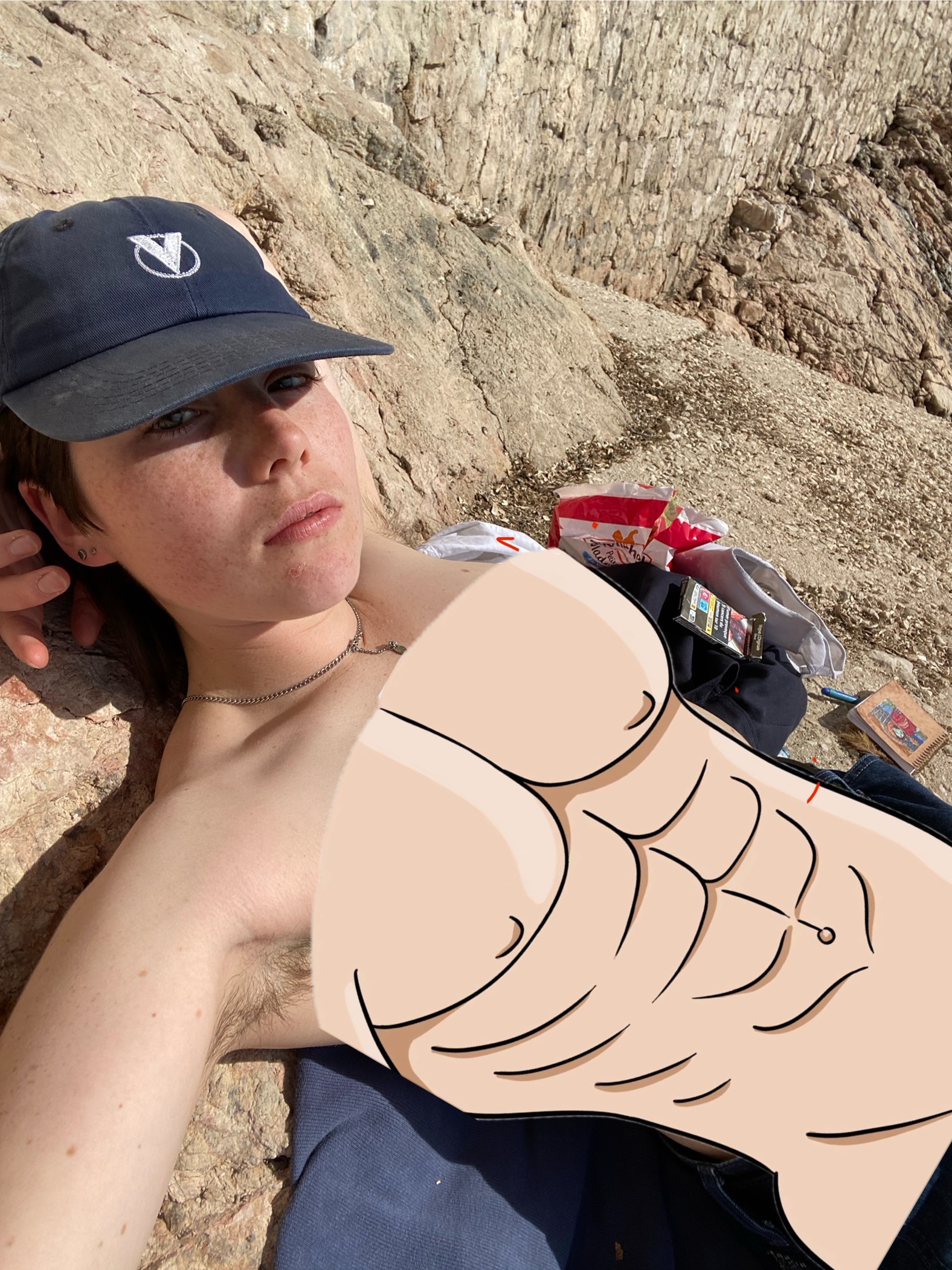 Elliot's Top surgery - torsoplastie campaign photo, 5 of 6