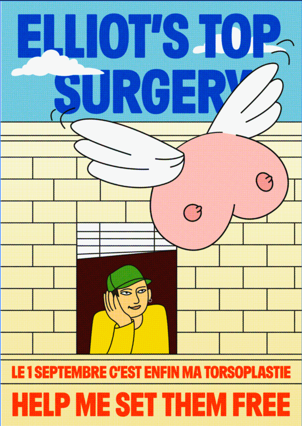 Elliot's Top surgery - torsoplastie campaign photo, 4 of 6