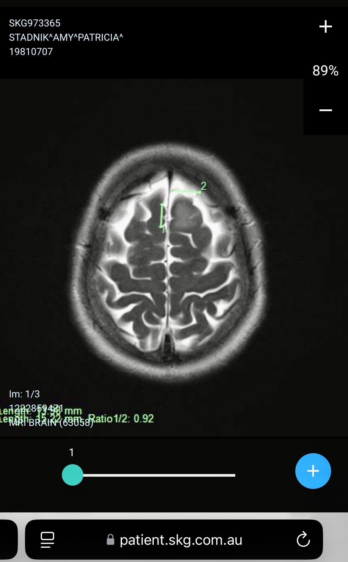 Let’s help Amy’s fight against a brain tumour  campaign photo, 4 of 8