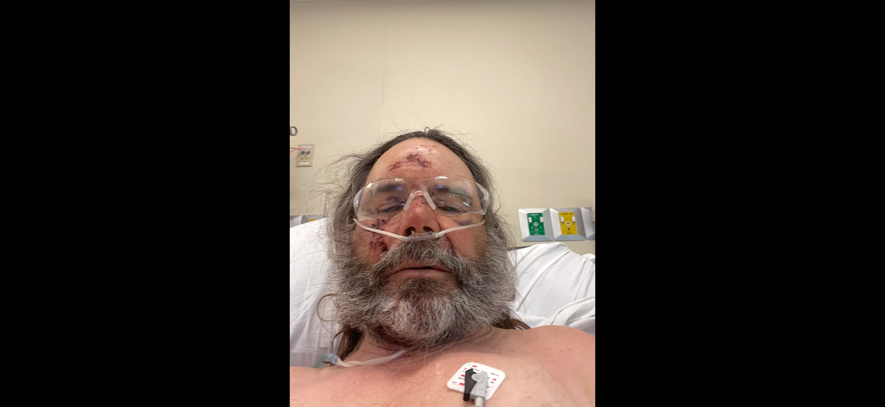 Support Jeff's Long Road to Recovery campaign photo, 4 of 5