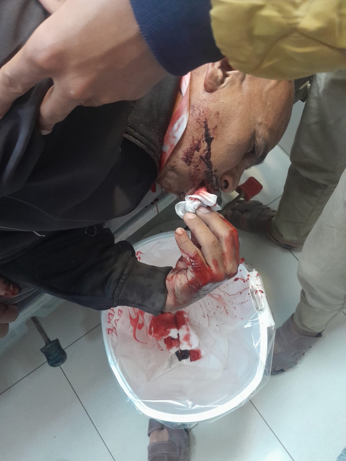 My Injured Father in Gaza .... Please Don't Look Away campaign photo, 7 of 8
