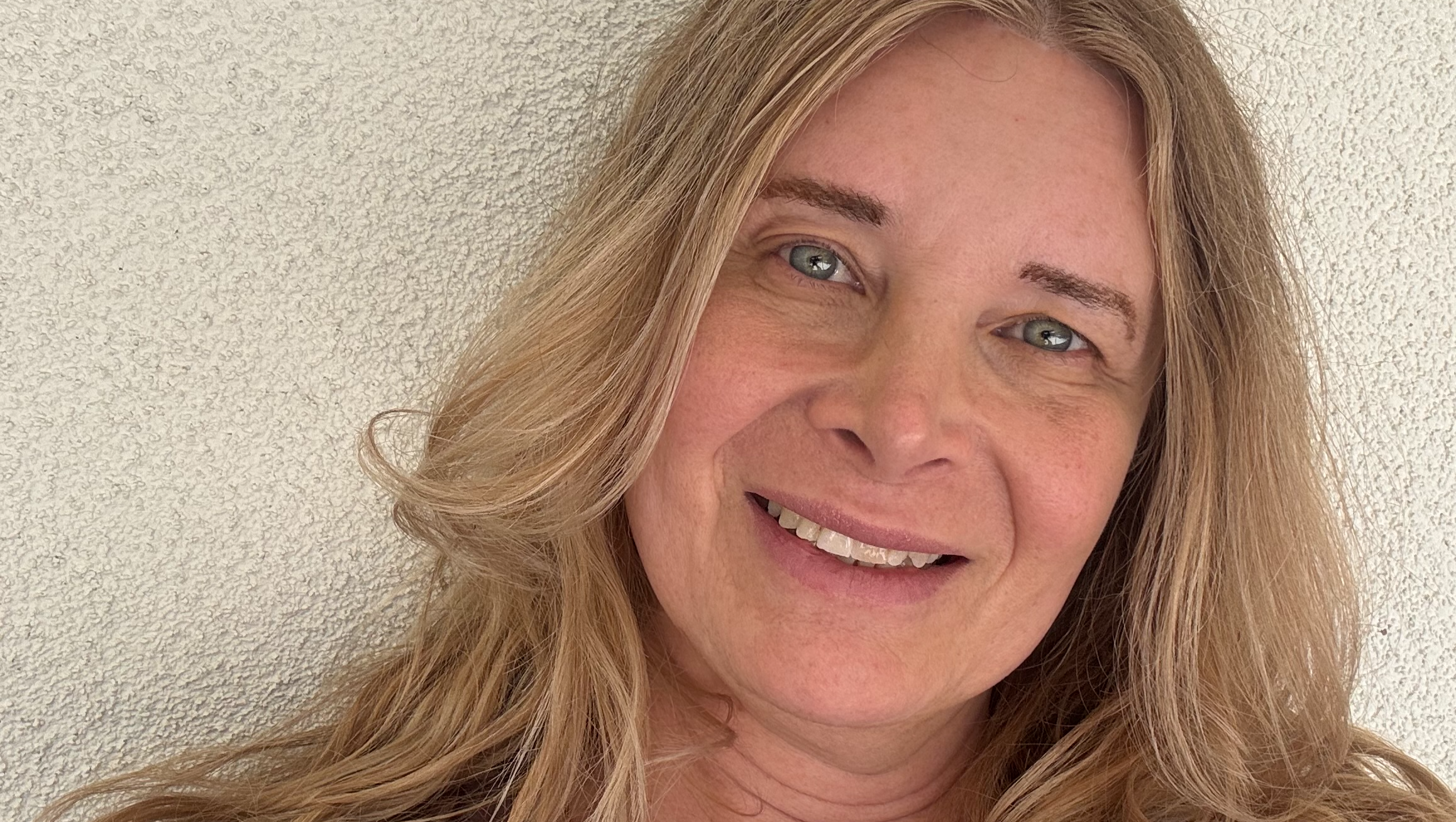 Help Fund Gender Confirming Surgery photo