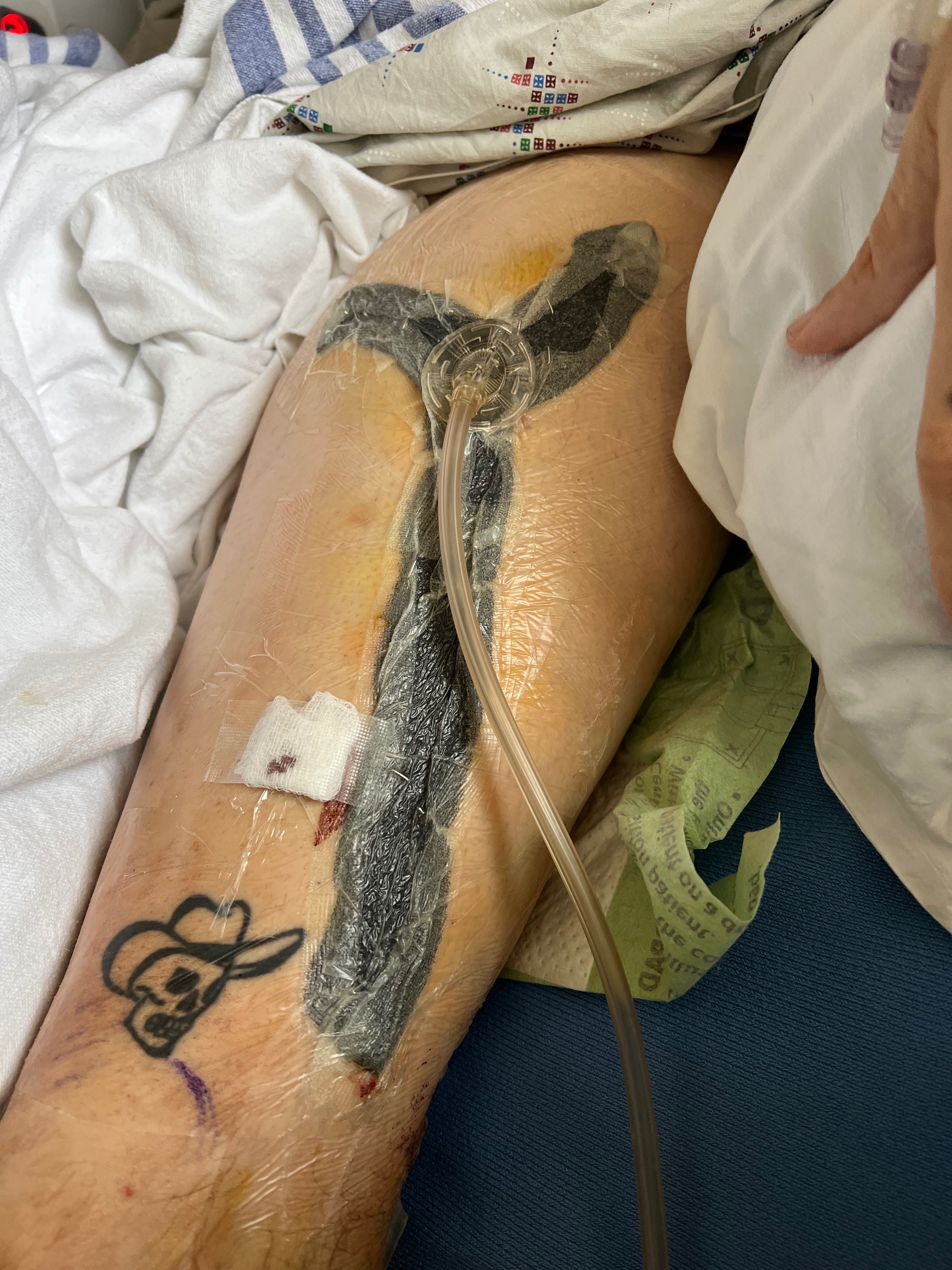Help Brandon Heal After Devastating Accident campaign photo, 5 of 8
