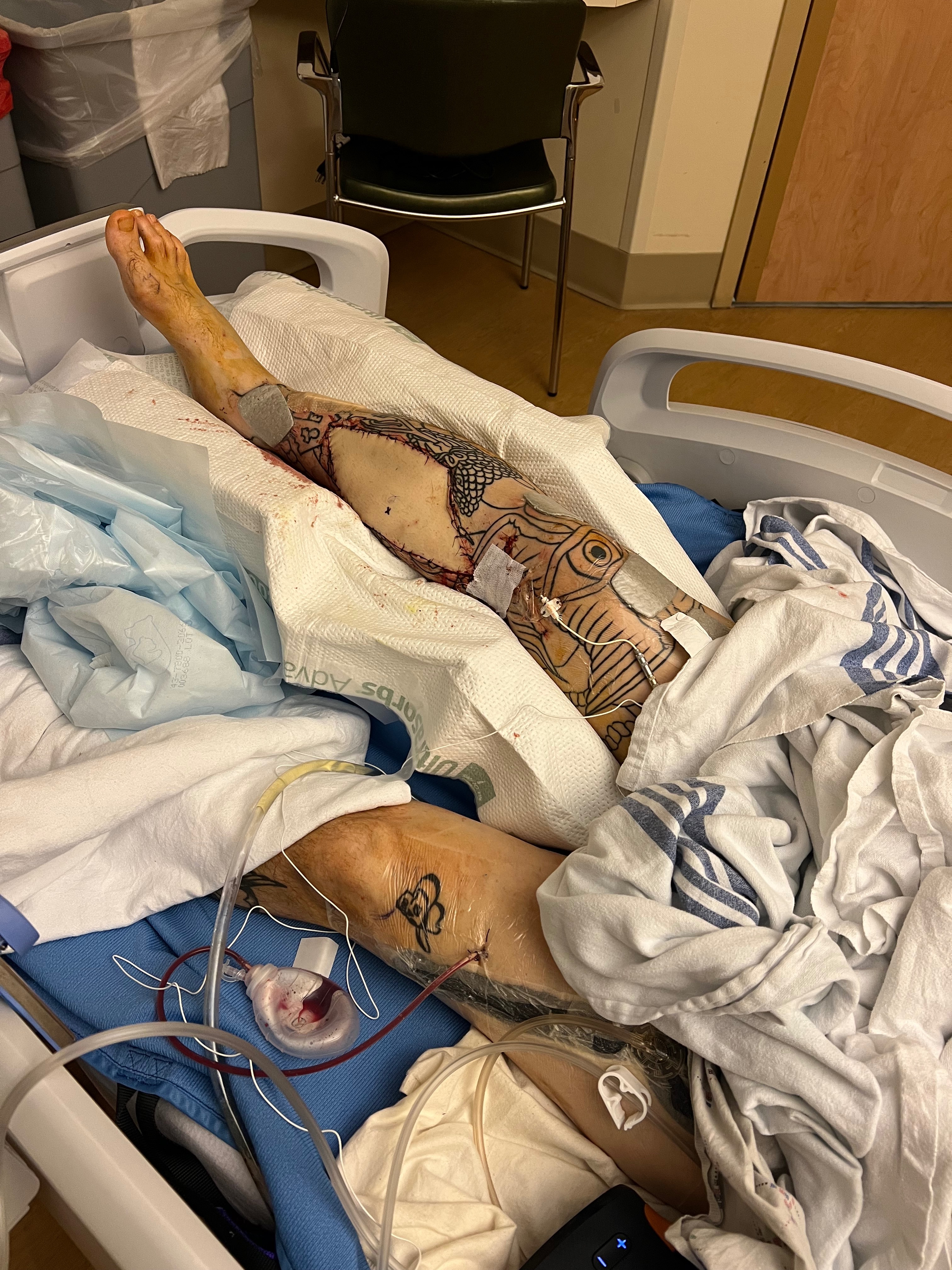 Help Brandon Heal After Devastating Accident campaign photo, 6 of 8
