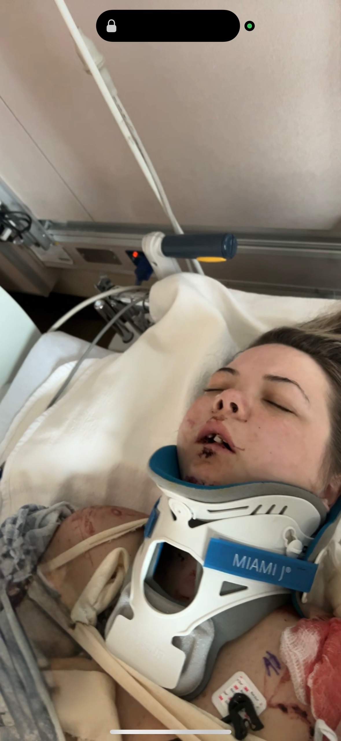 Help Kylie heal after her terrible accident campaign photo, 2 of 4