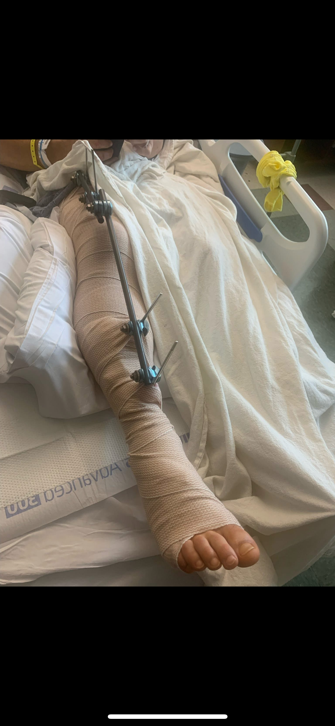 Aid Brandon After His Severe Leg Break campaign photo, 5 of 7
