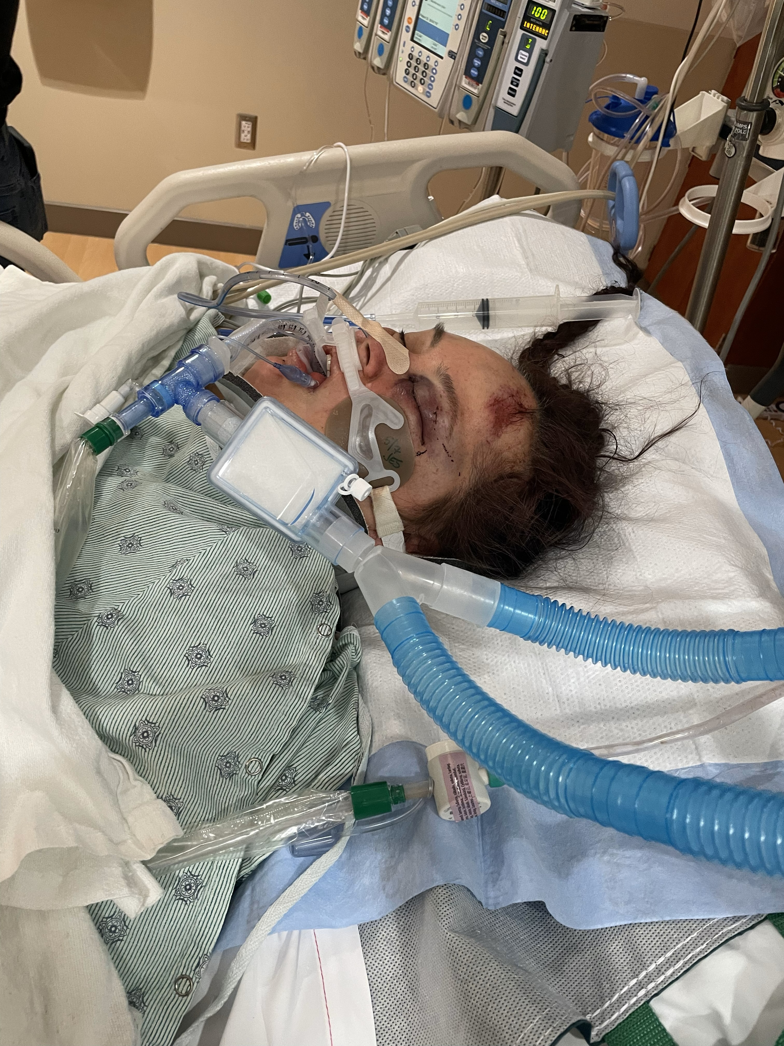 Support Raven Lawrence's Road to Recovery campaign photo, 2 of 4