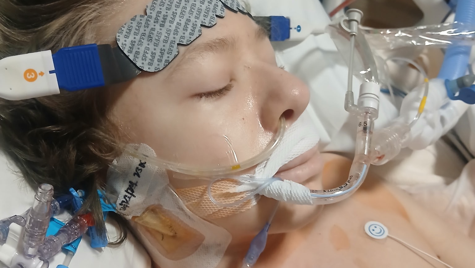 Fundraiser for Travis Reeves by Sandi Burns : Help Trevor's Family ...