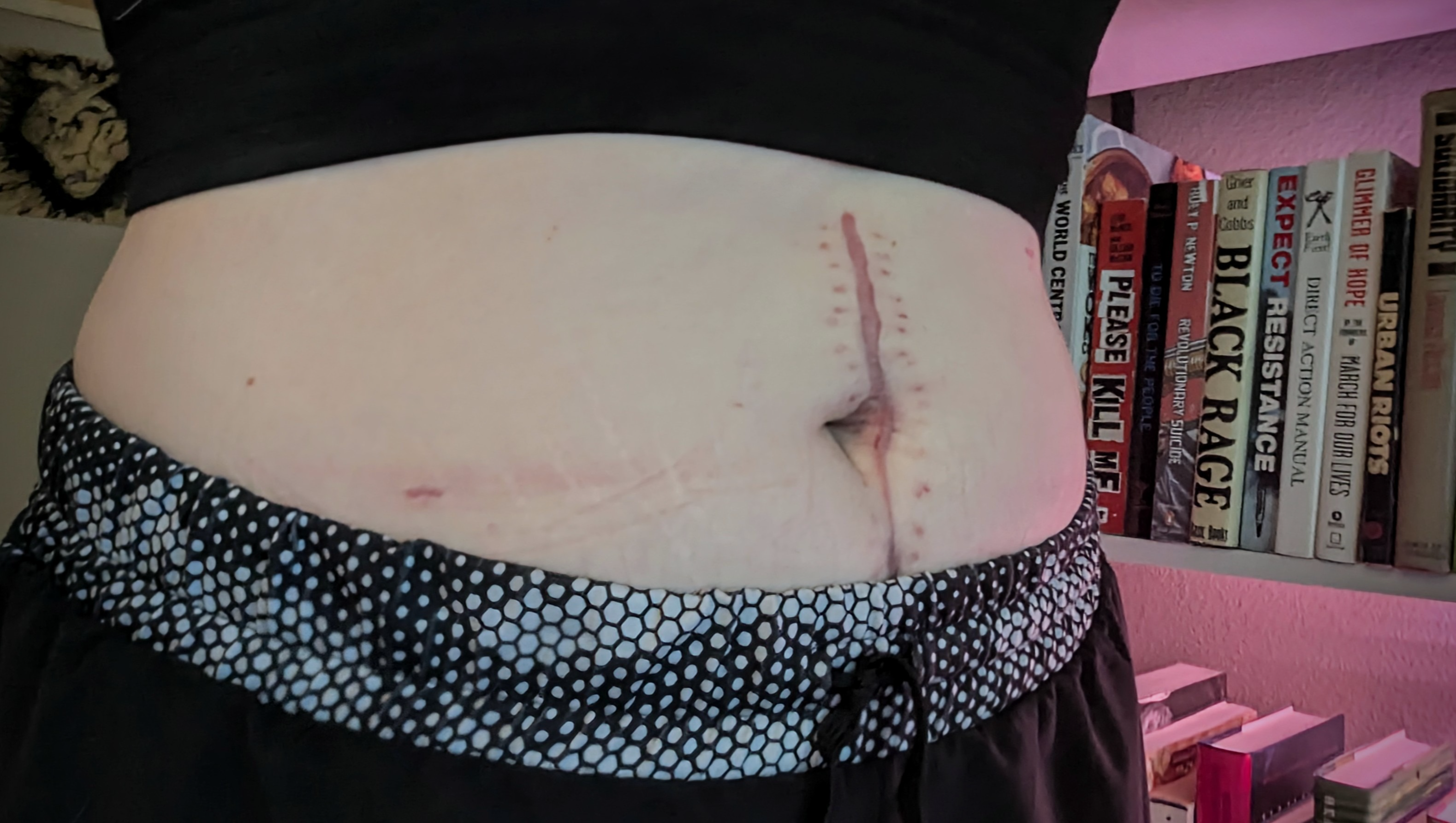 Help a Portland Activist Recover From Emergency Surgery