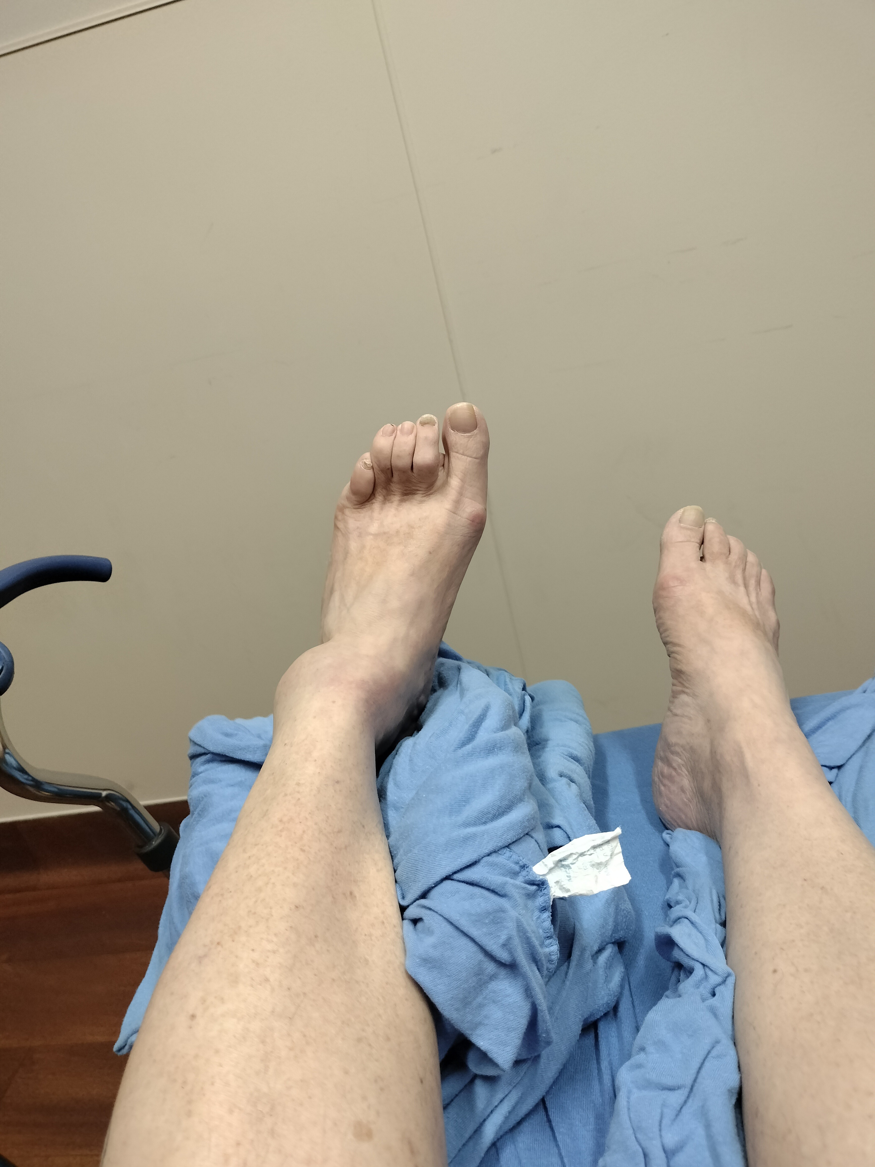Kelene Needs Your Help for Her Ankle Recovery campaign photo, 2 of 5