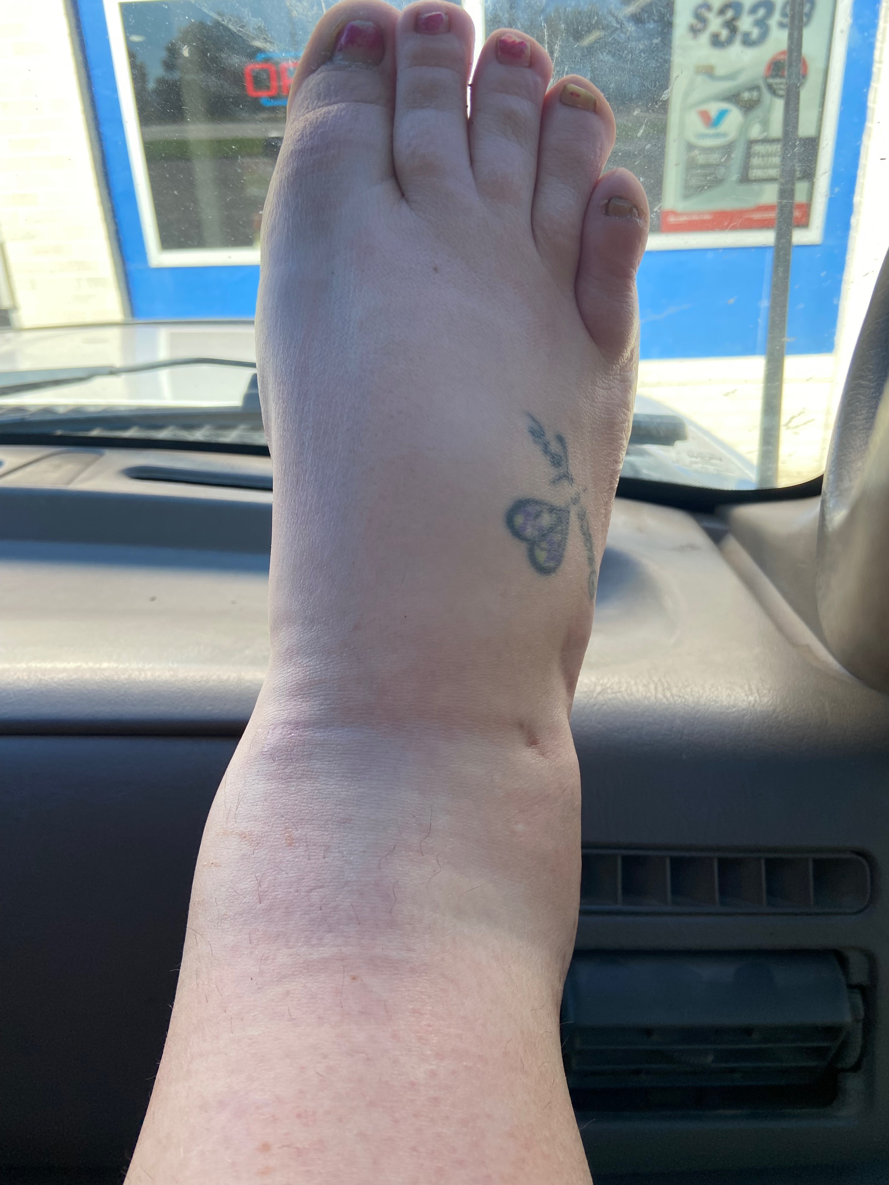 Help Emily Heal: Surgery and Therapy Fund campaign photo, 7 of 8