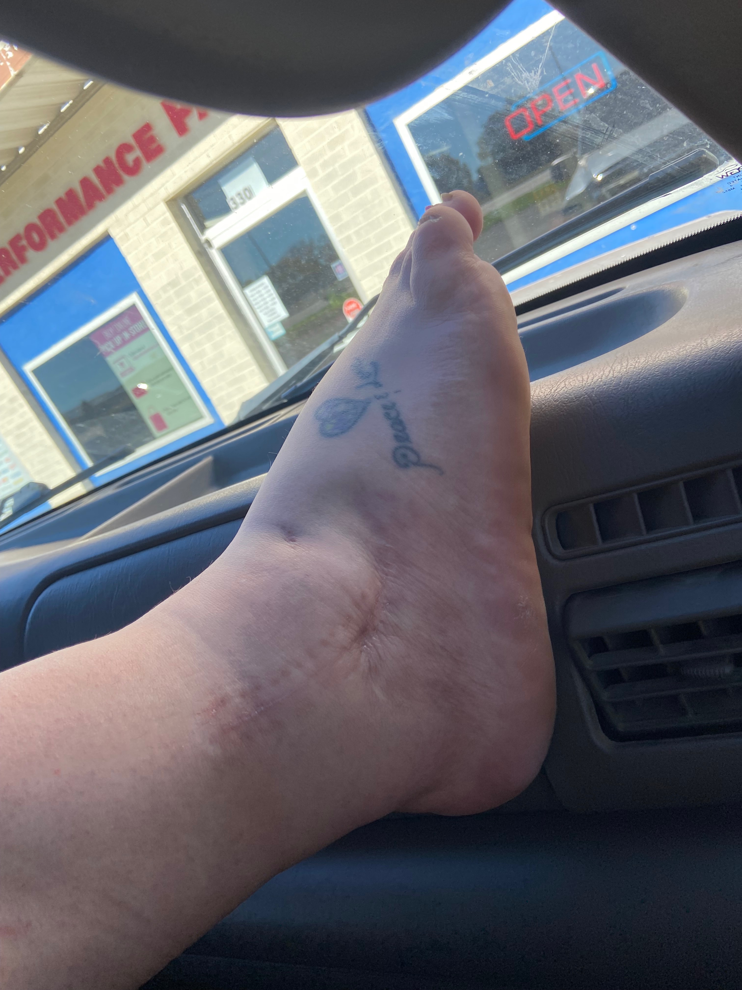 Help Emily Heal: Surgery and Therapy Fund campaign photo, 2 of 8