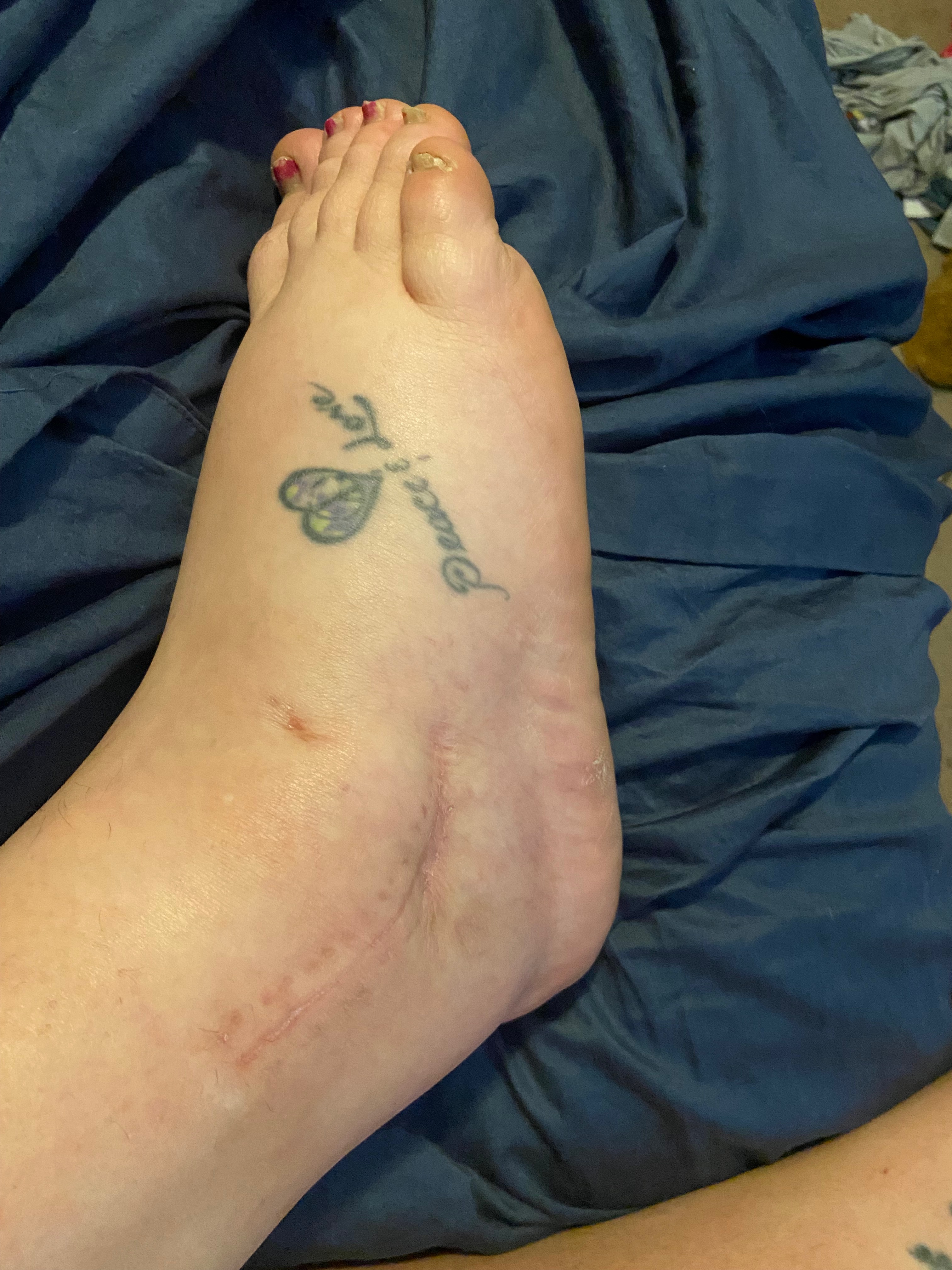 Help Emily Heal: Surgery and Therapy Fund campaign photo, 4 of 8