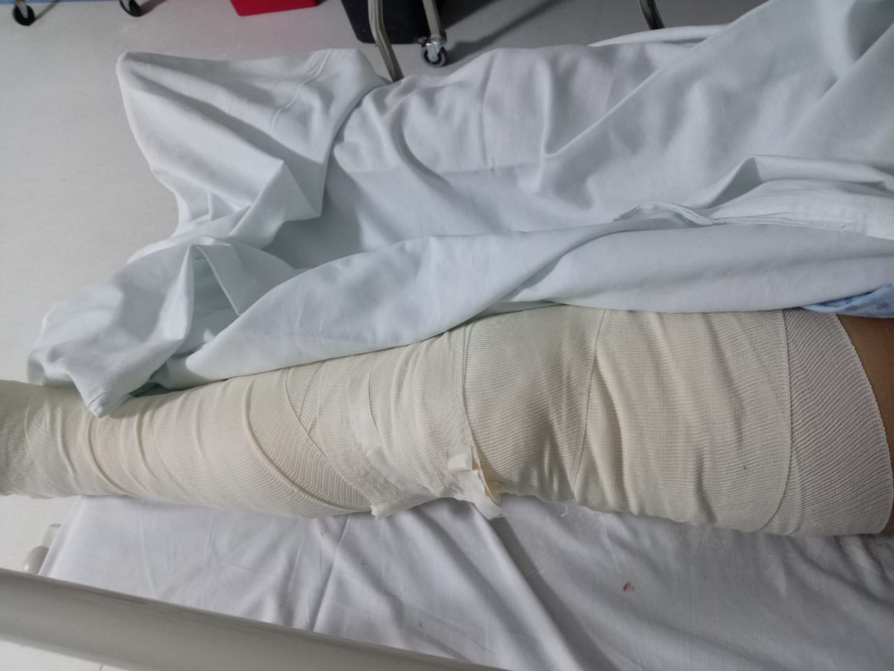 Help Leonardo Zavalza Get Urgent Surgery campaign photo, 5 of 8
