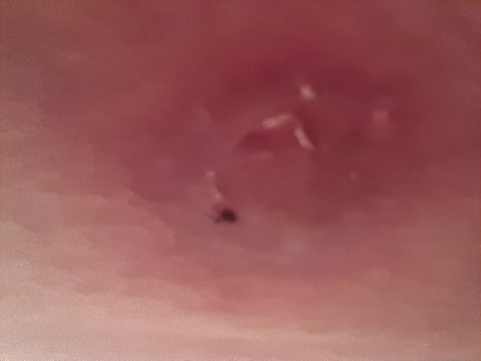 Support Hope Solly's Fight Against Tunga penetrant campaign photo, 2 of 5