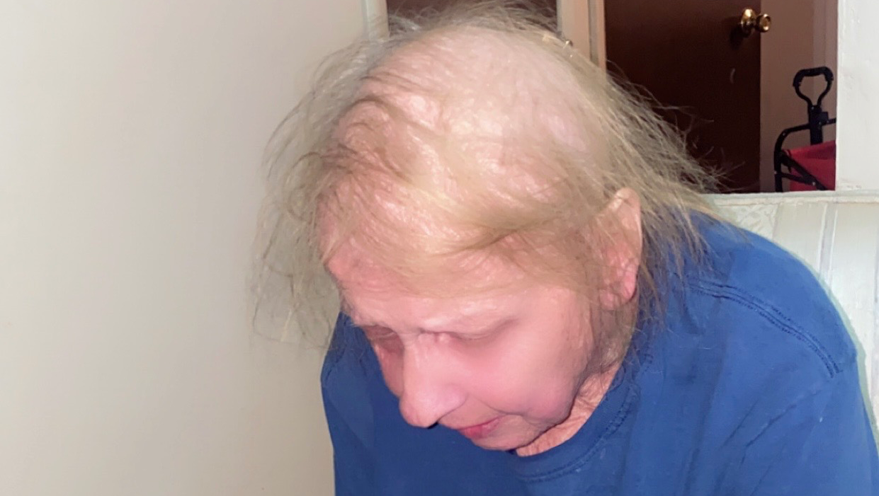 Help Catherine Fight Breast Cancer and Recover After Surgery photo