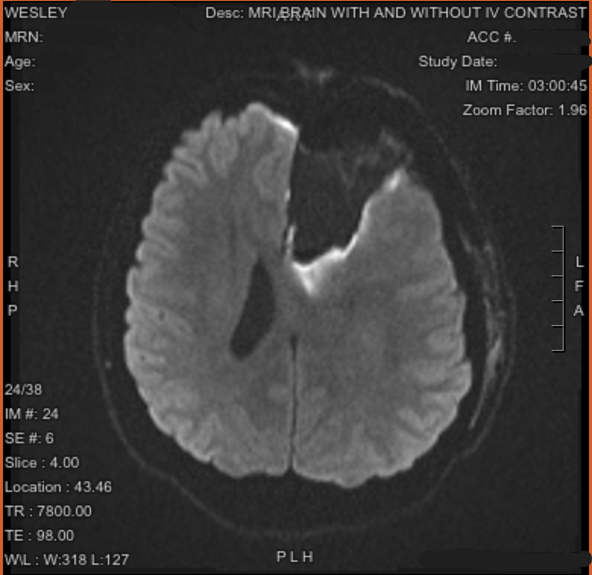 From Brain Surgery to Bills, Help Us Through This Storm campaign photo, 4 of 8