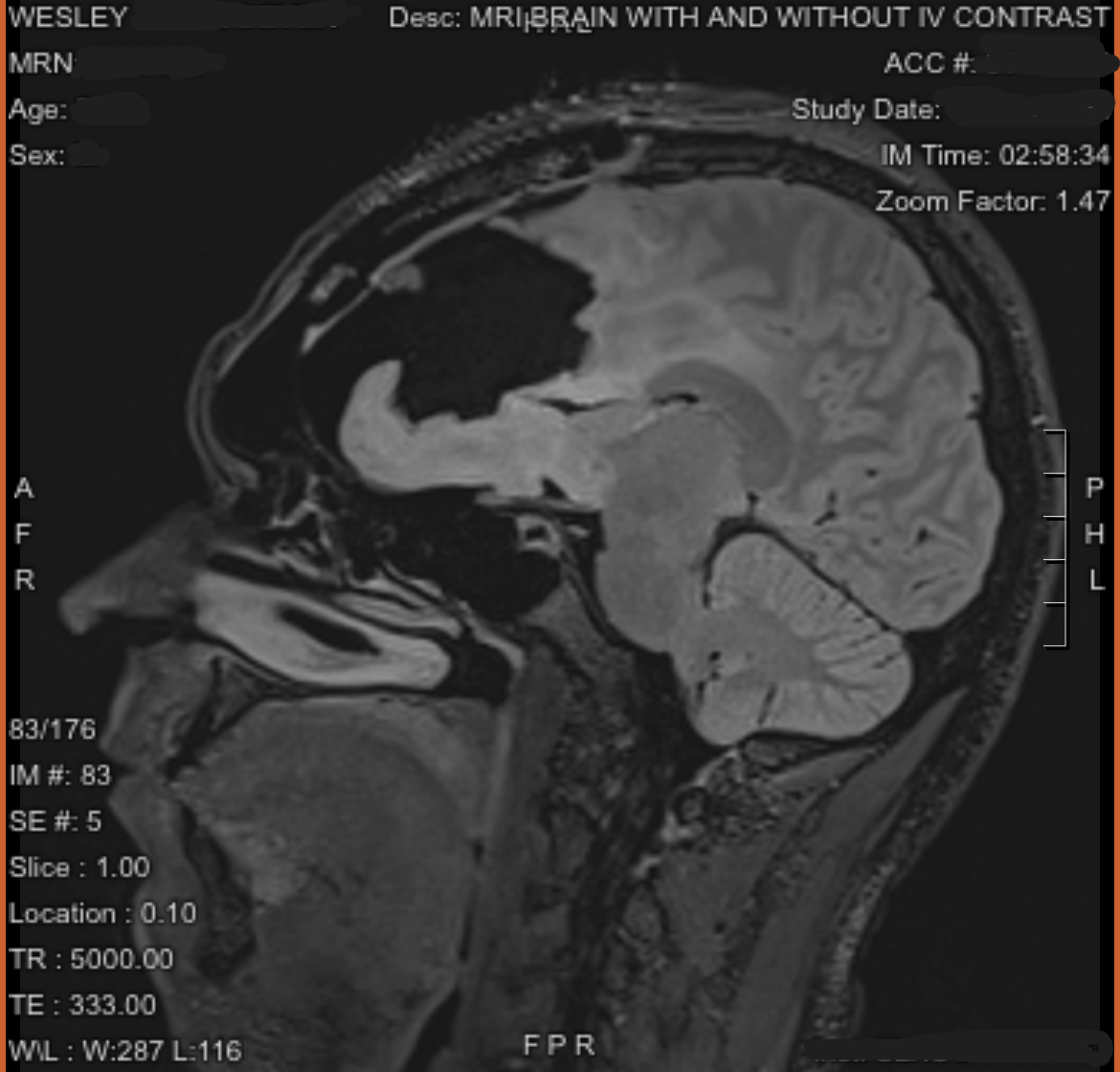 From Brain Surgery to Bills, Help Us Through This Storm campaign photo, 5 of 8
