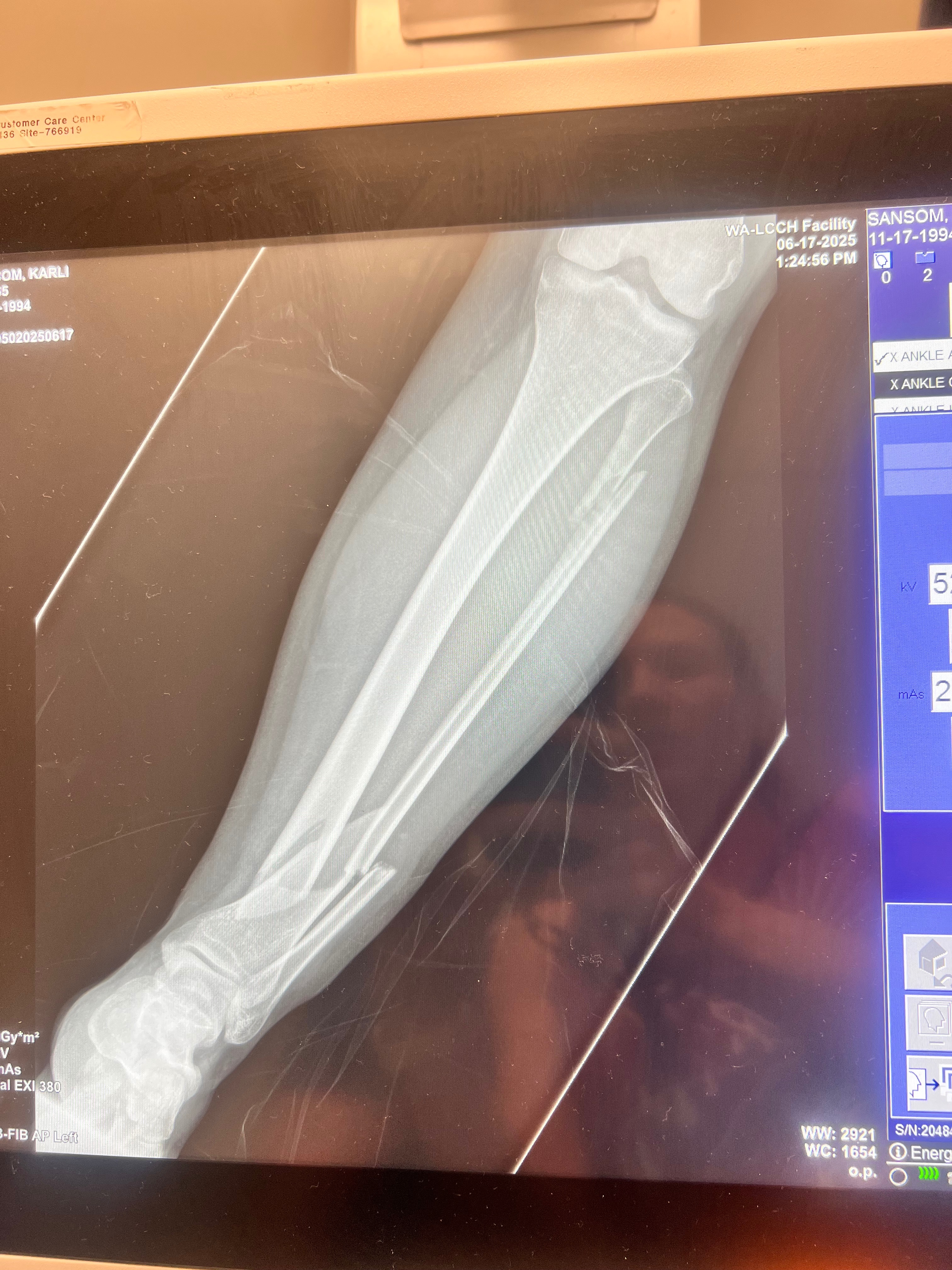 Karli's Journey: Healing Her Broken Leg and spirits up! campaign photo, 2 of 5