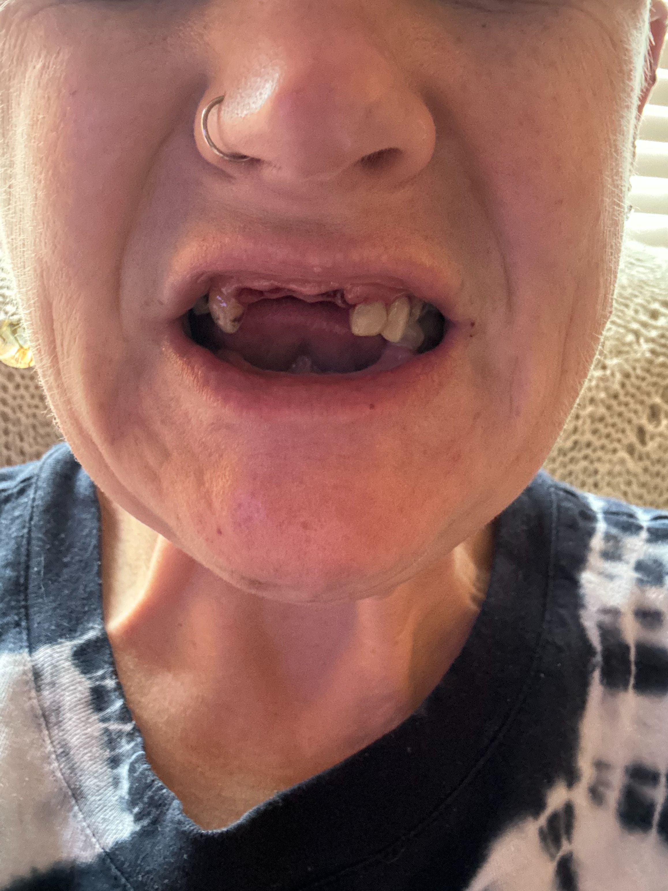 Give Amanda the Gift of a Healthy Smile campaign photo, 2 of 4