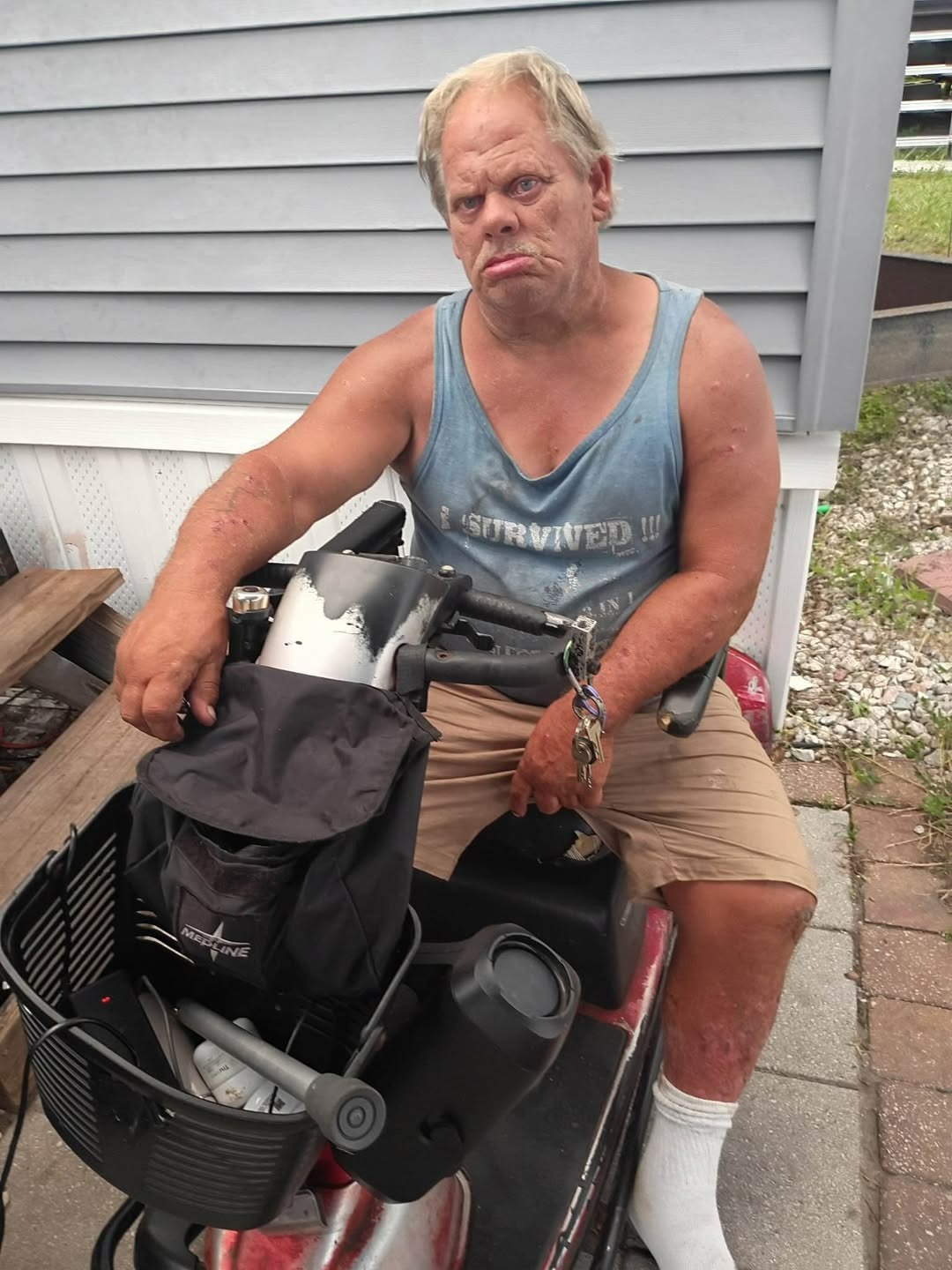 Donate to Eddy's Life-Changing Surgery campaign photo, 4 of 4
