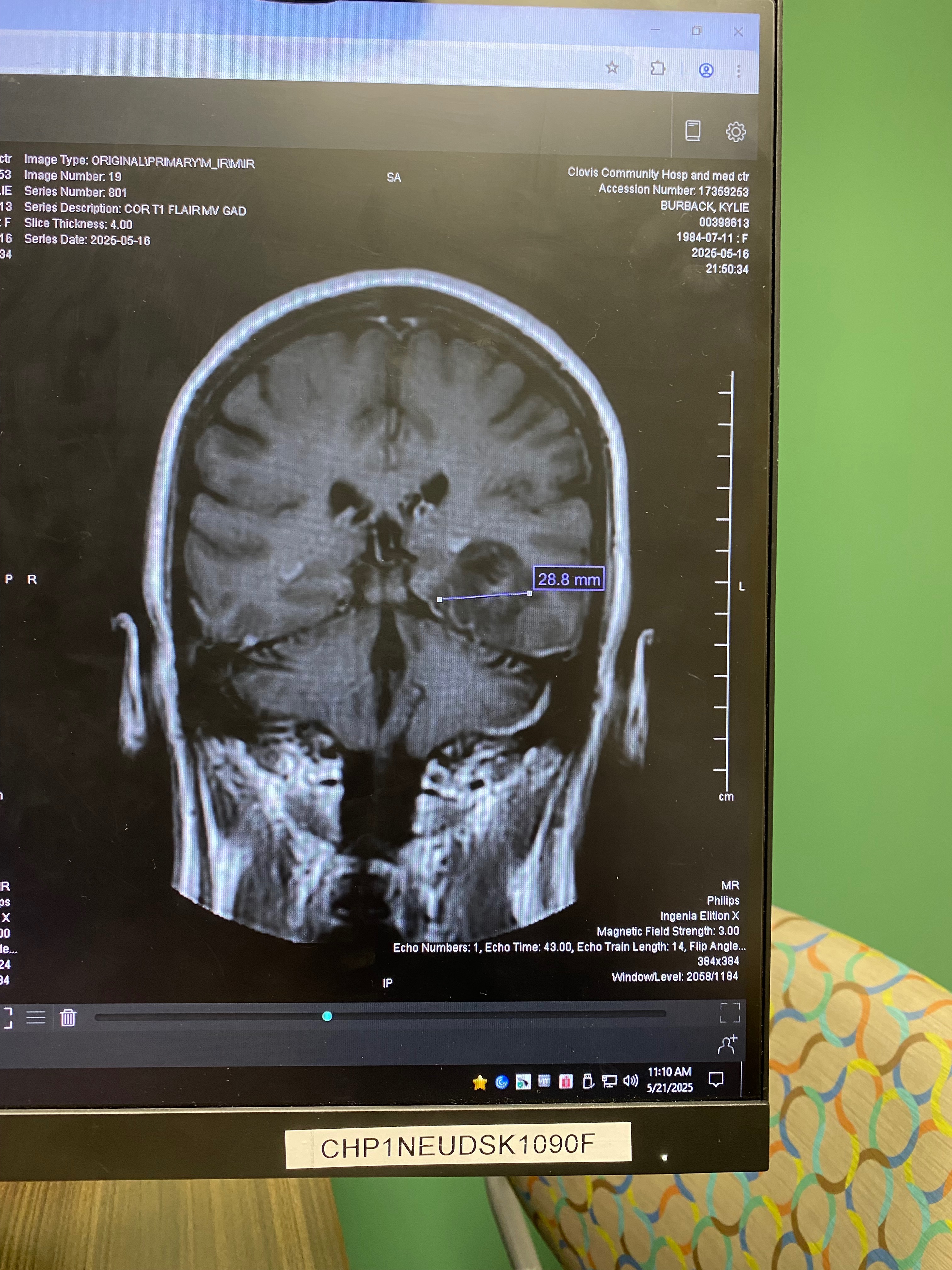 Support Kylie’s Battle Against Brain Tumor Gofundme