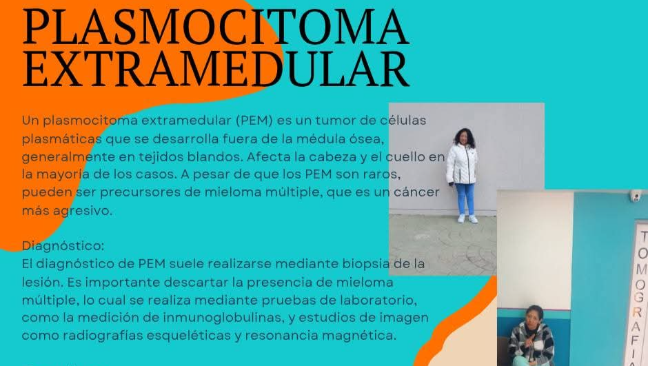 Karla Ovando Plasmocitoma Extramedular photo