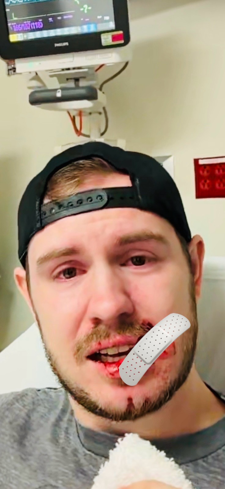 Help Tyler Heal: Support After Dog Attack Gofundme
