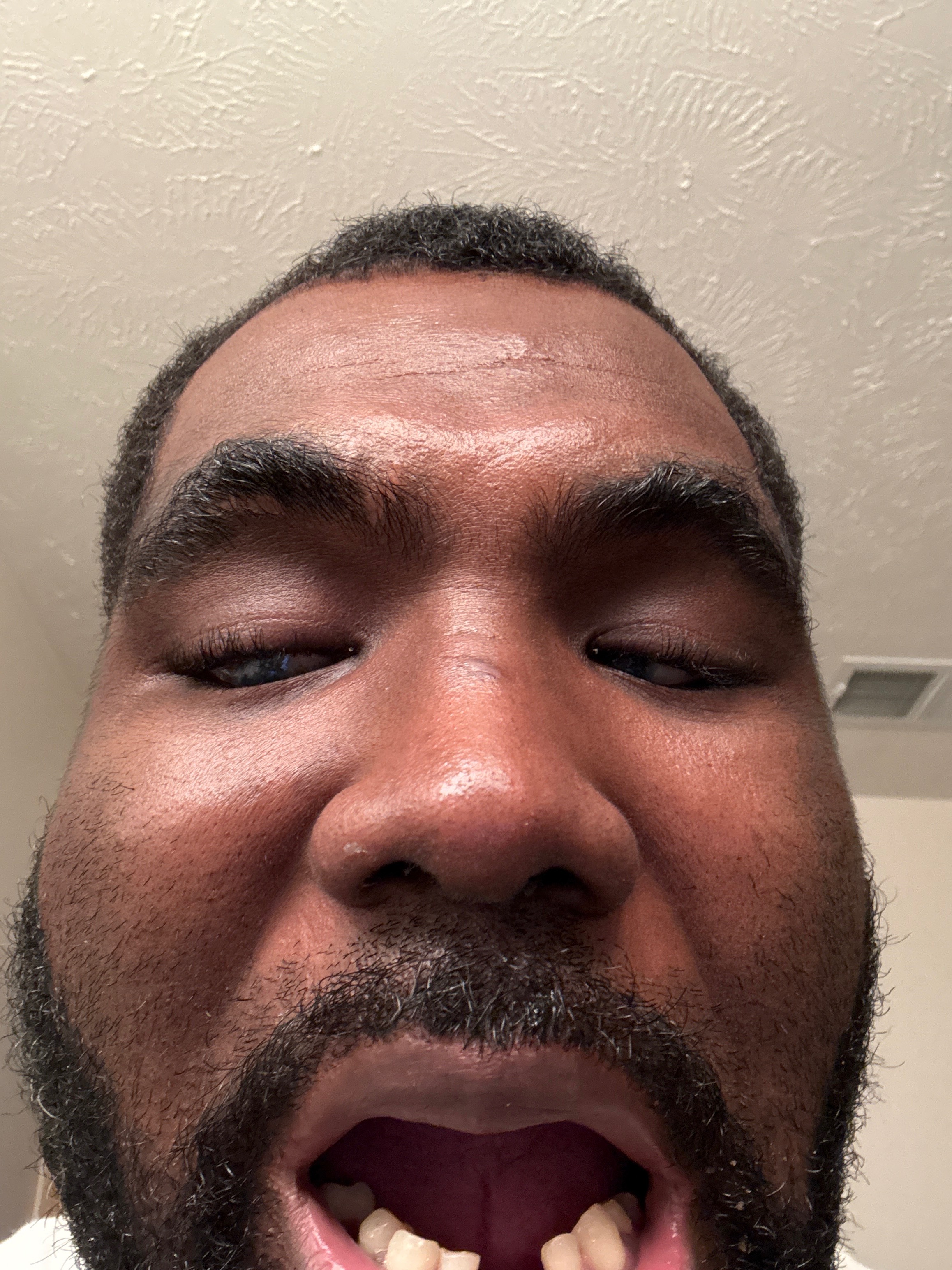Restore Anthony’s Confidence with New Teeth Gofundme