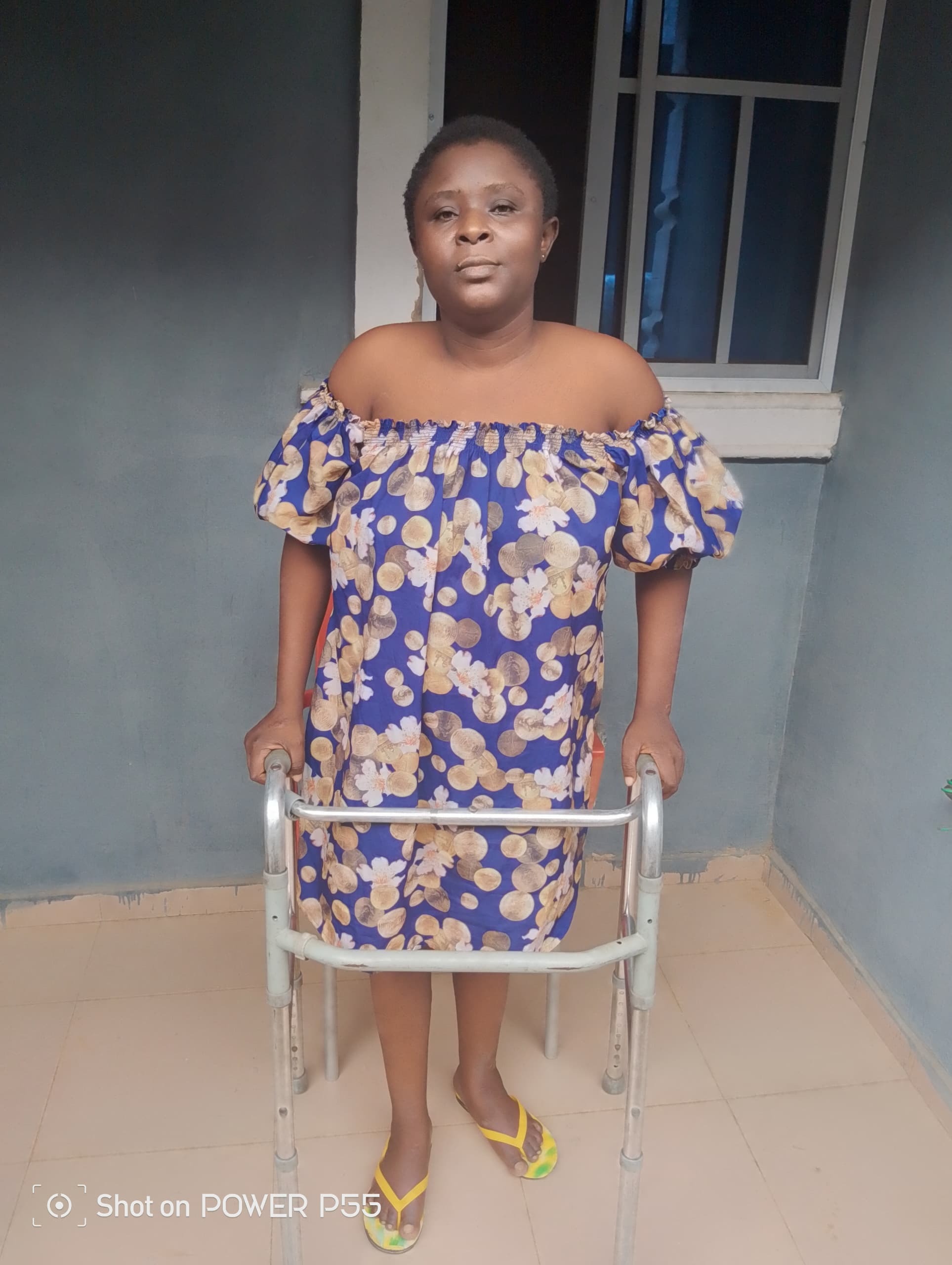 Help Odey Overcome Her Paralysis Gofundme