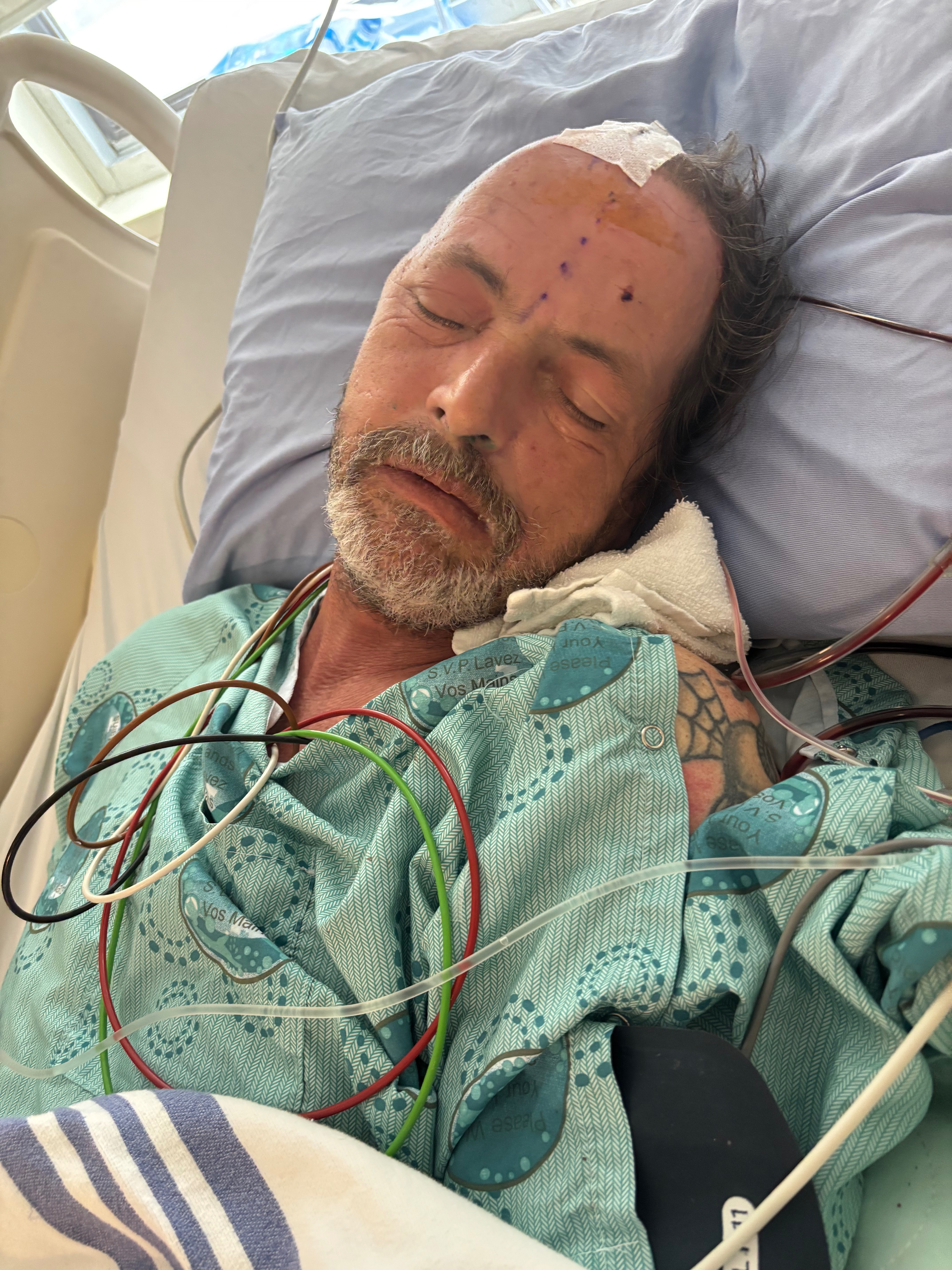 Richard Oliver Emergency brain surgery Gofundme