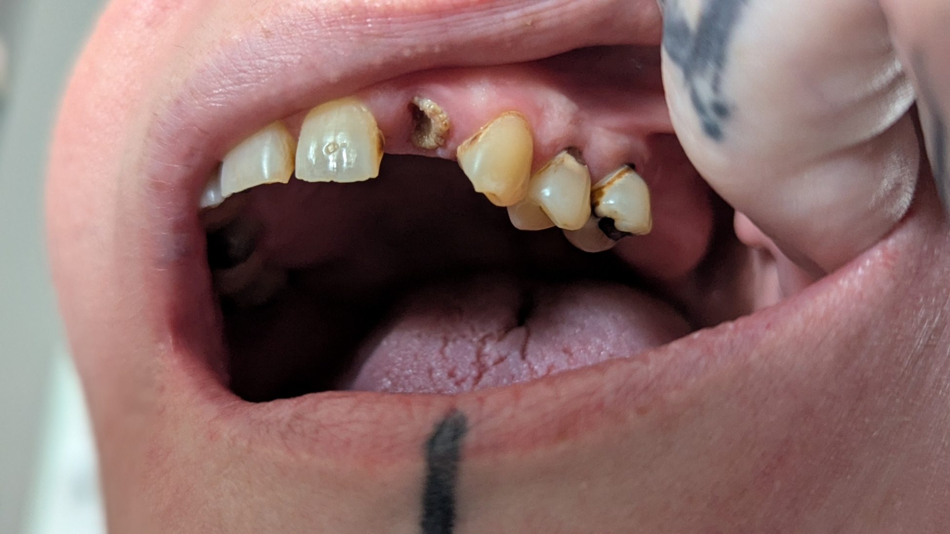 Decay To Dentures campaign photo, 6 of 7