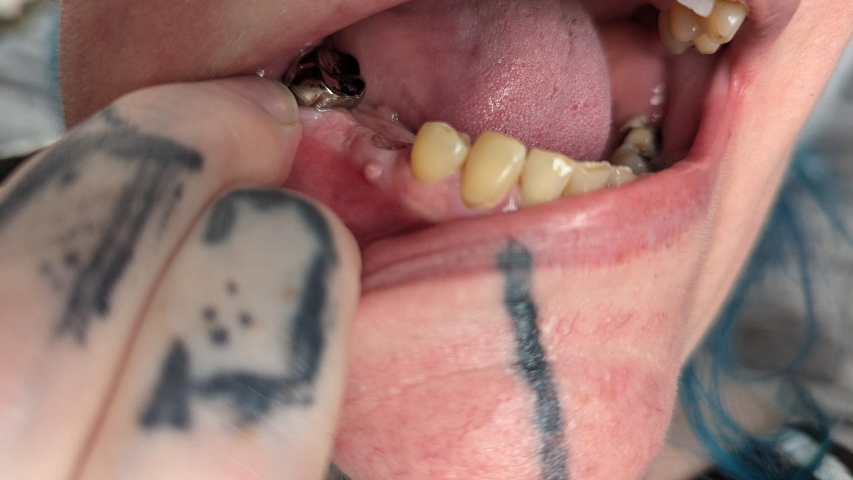 Decay To Dentures campaign photo, 2 of 7