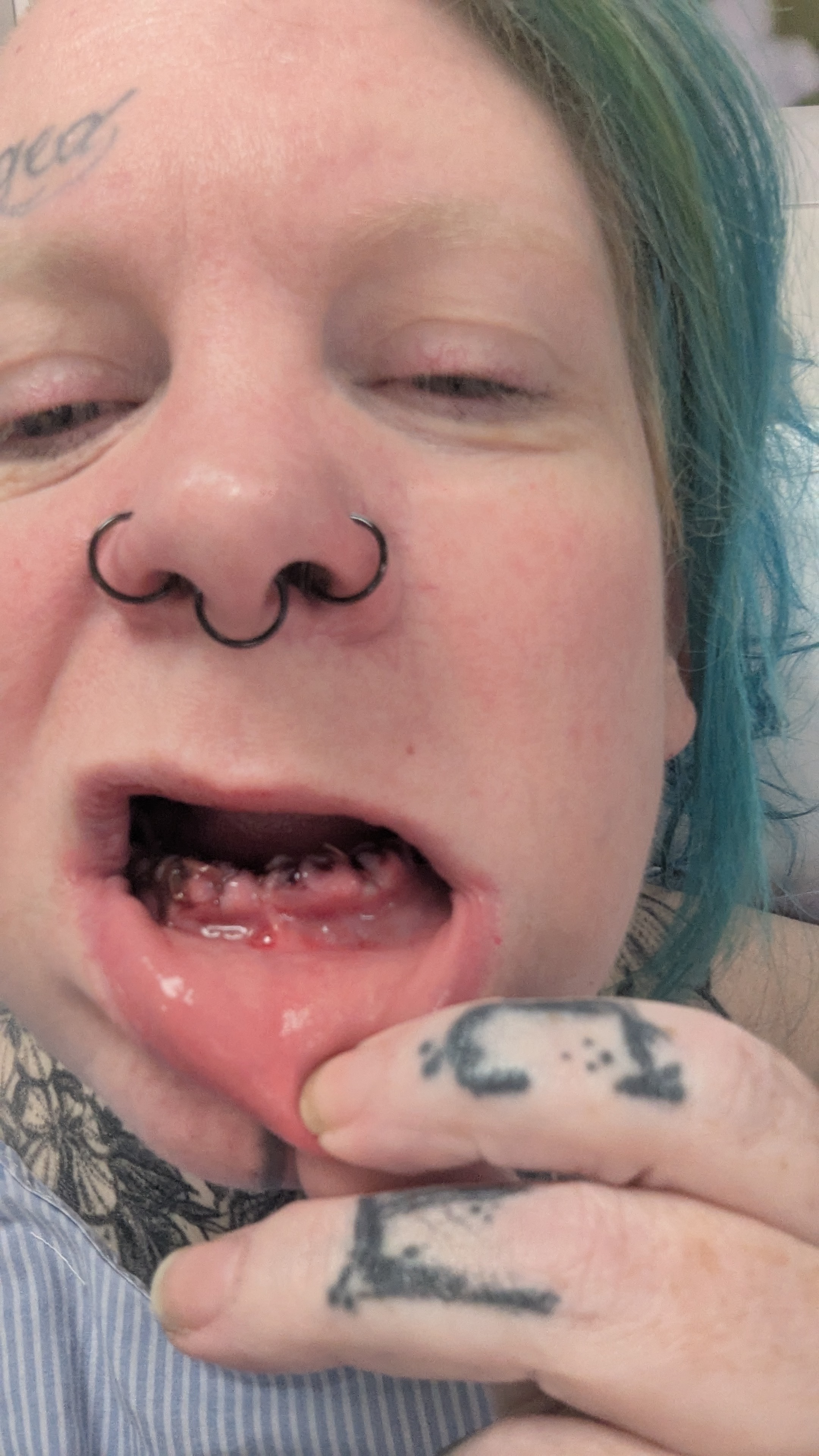 Decay To Dentures campaign photo, 5 of 7