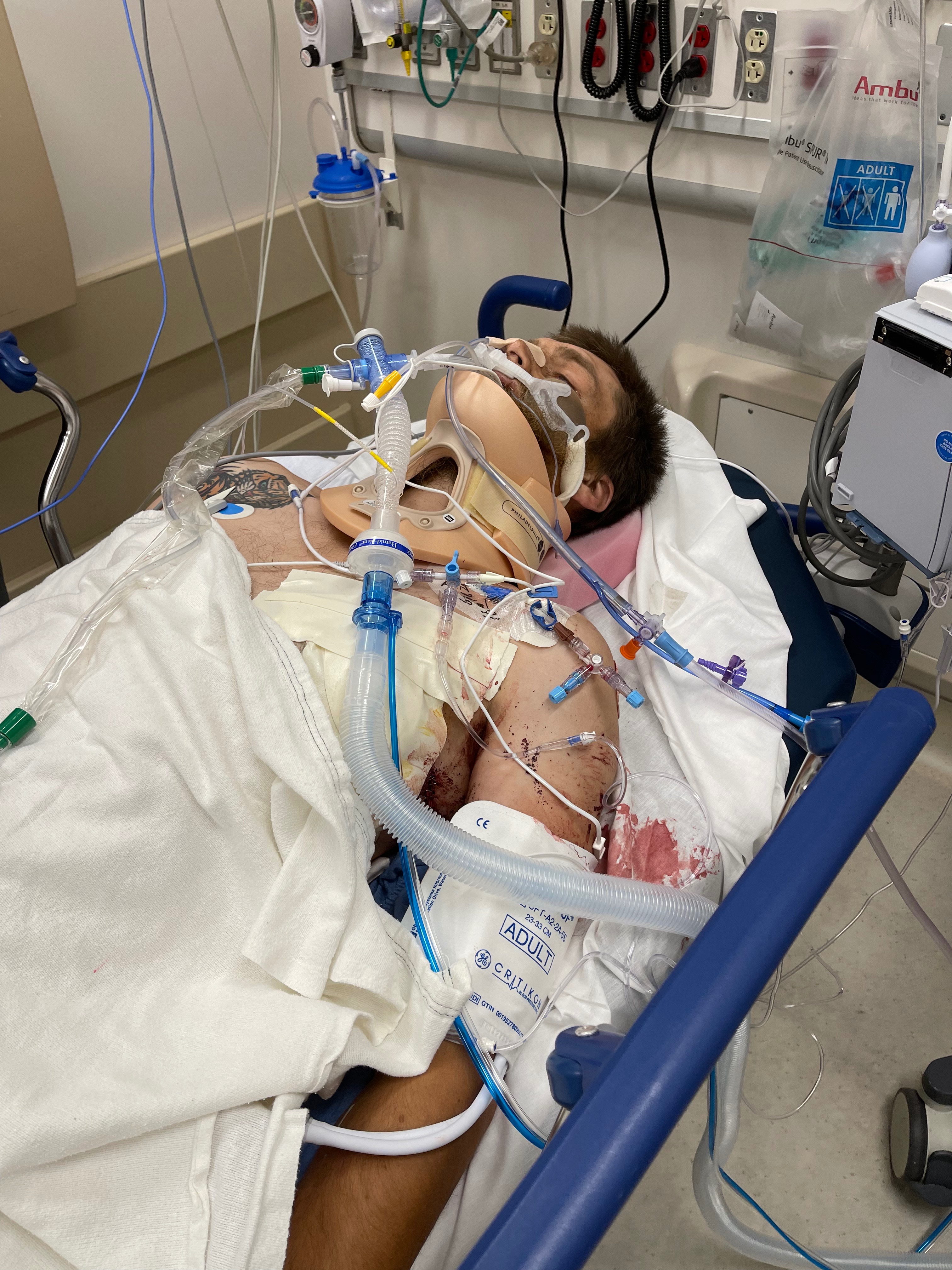 Help Cameron Recover from Devastating Accident campaign photo, 5 of 6