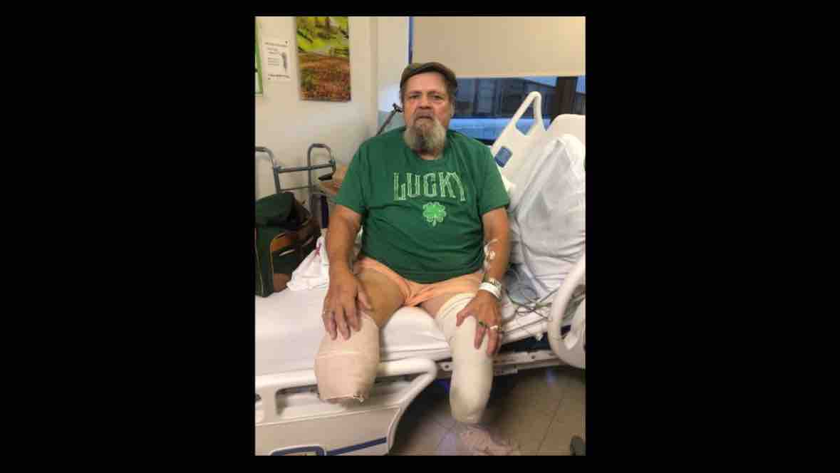 Help My Dad Drive Again After Life-Altering Amputations photo