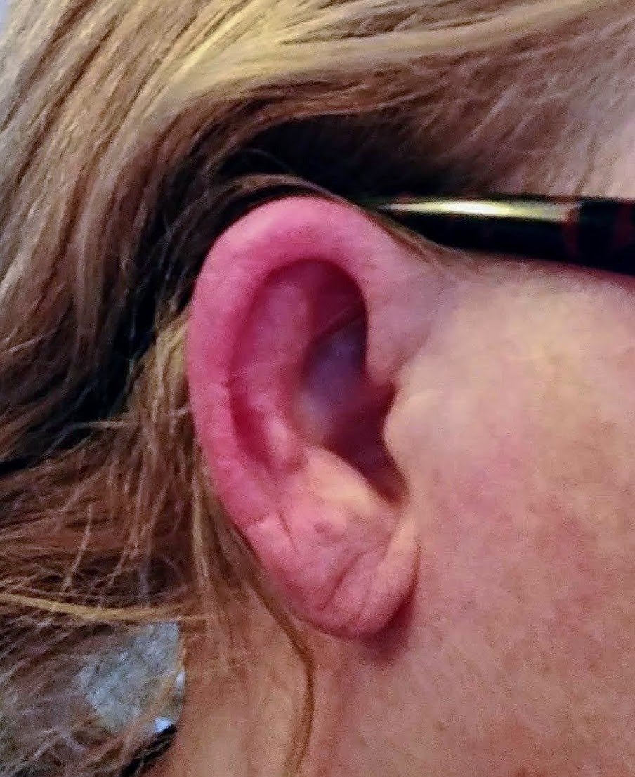 Donate to Susie Ratledge's Health Coverage campaign photo, 2 of 4