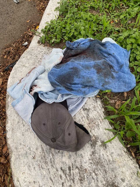 2-WEEK update: 82-yr-old injured Ajijic man still needs help campaign photo, 2 of 6