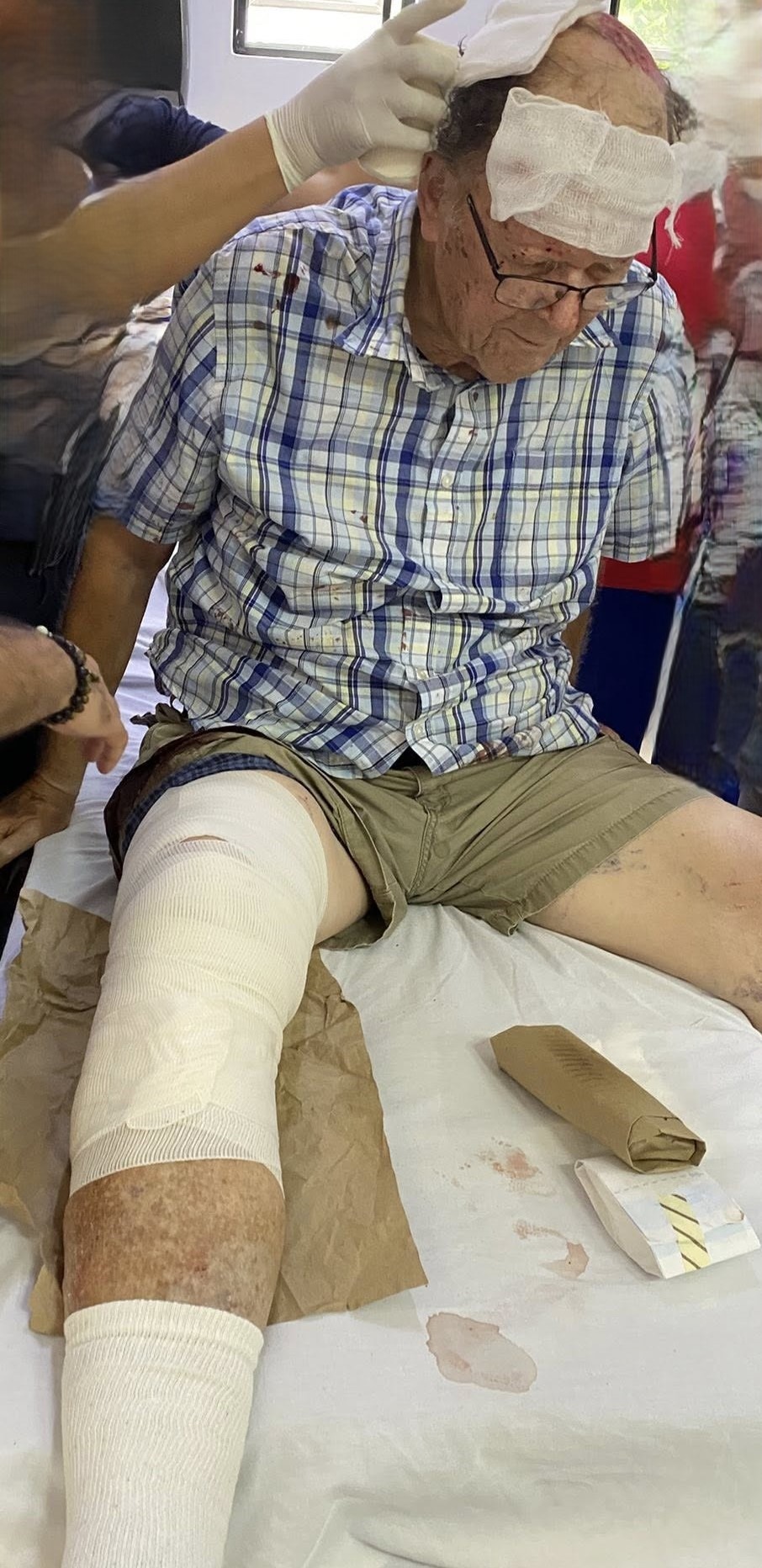 2-WEEK update: 82-yr-old injured Ajijic man still needs help campaign photo, 5 of 6