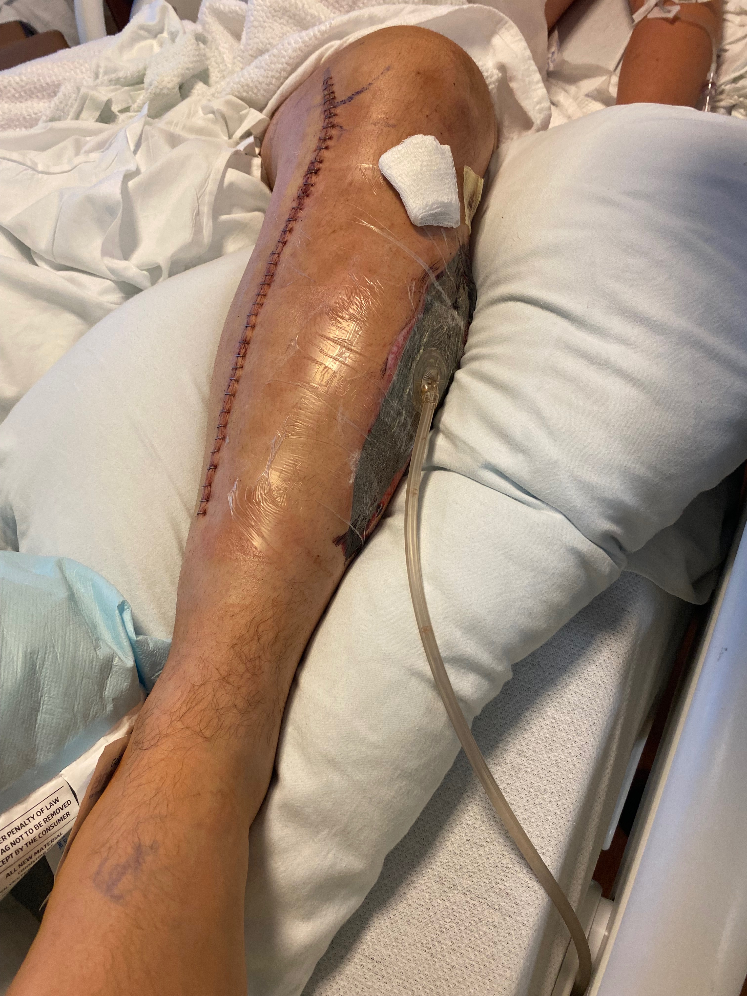 Help a Family Rebuild After Son's Accident campaign photo, 7 of 8