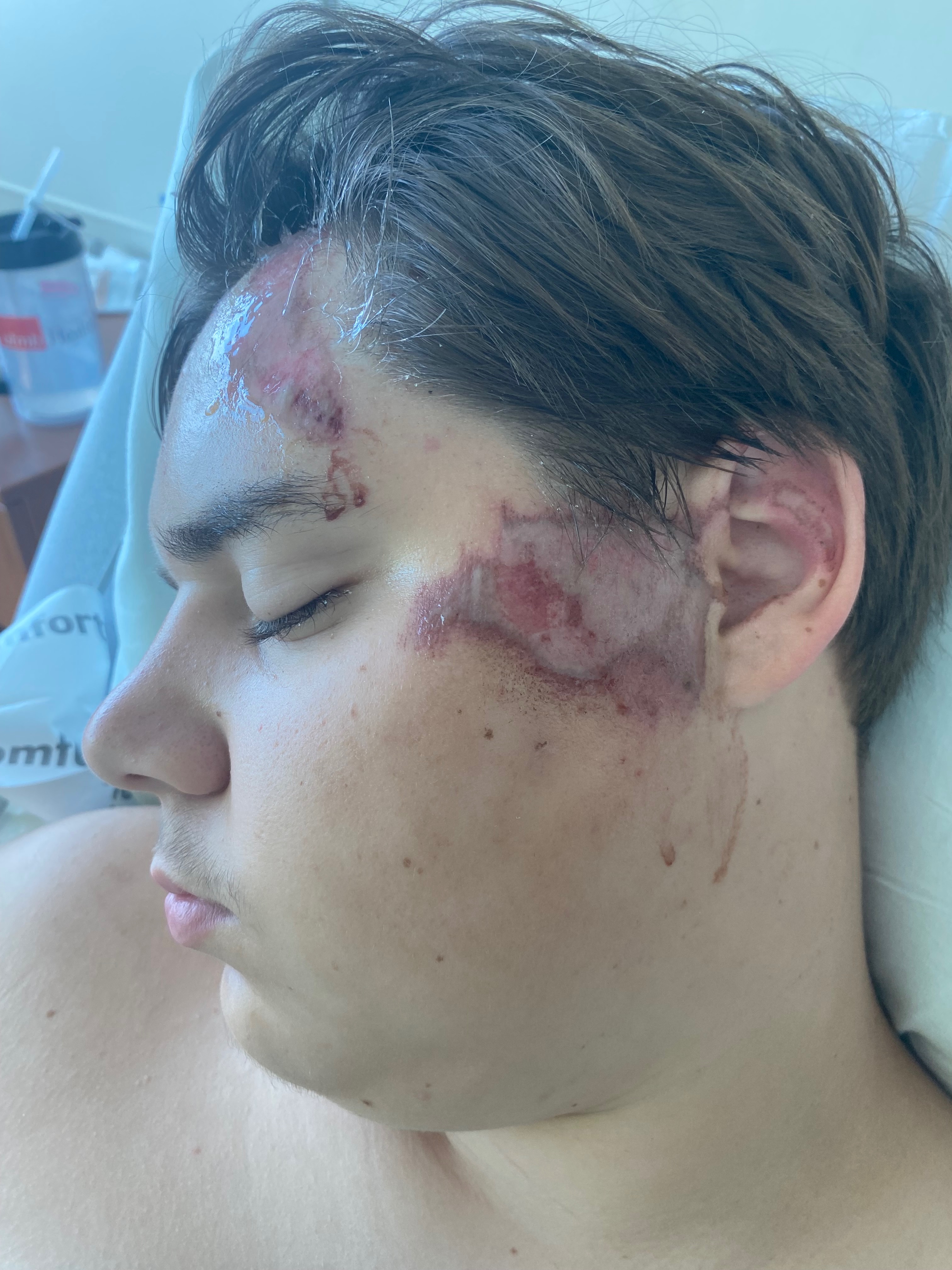 Help a Family Rebuild After Son's Accident campaign photo, 4 of 8