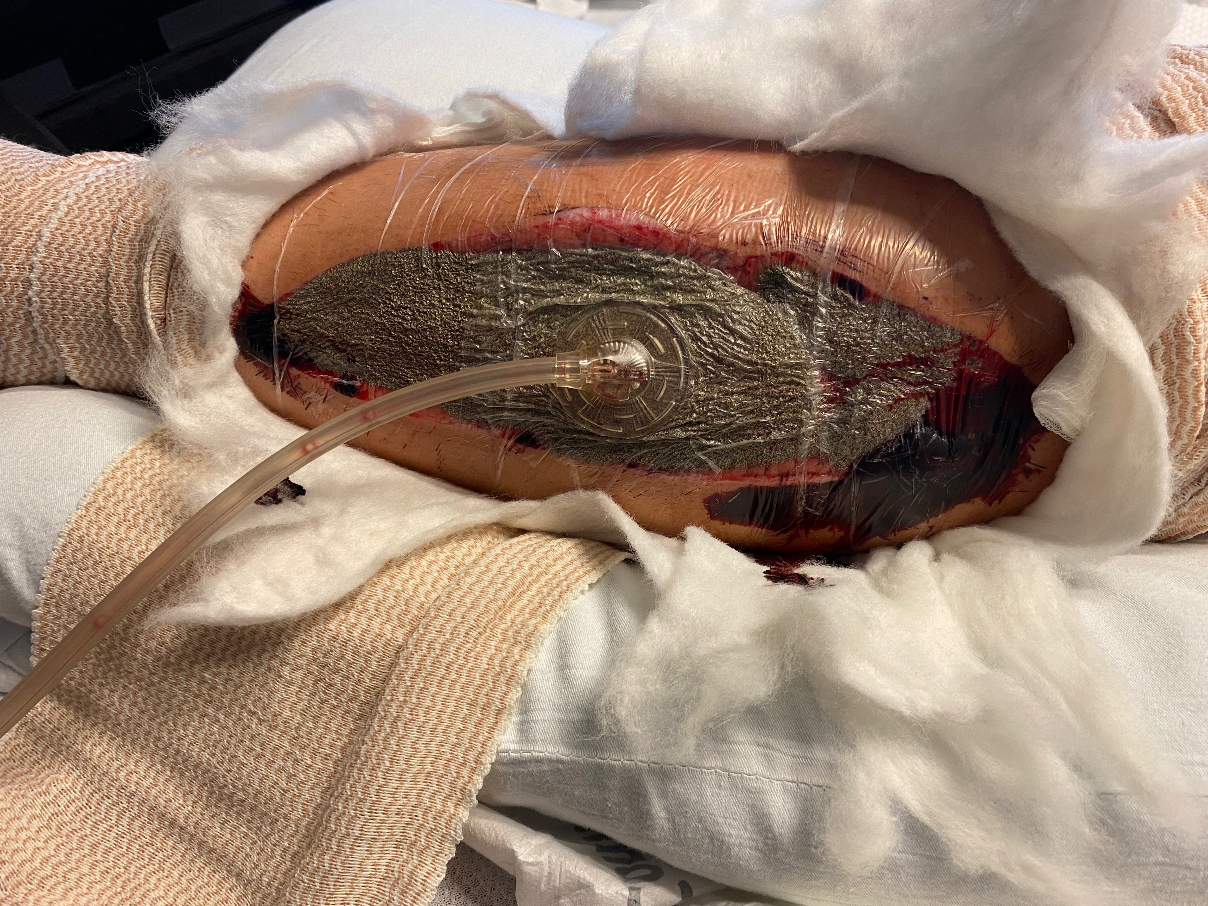 Help a Family Rebuild After Son's Accident campaign photo, 6 of 8