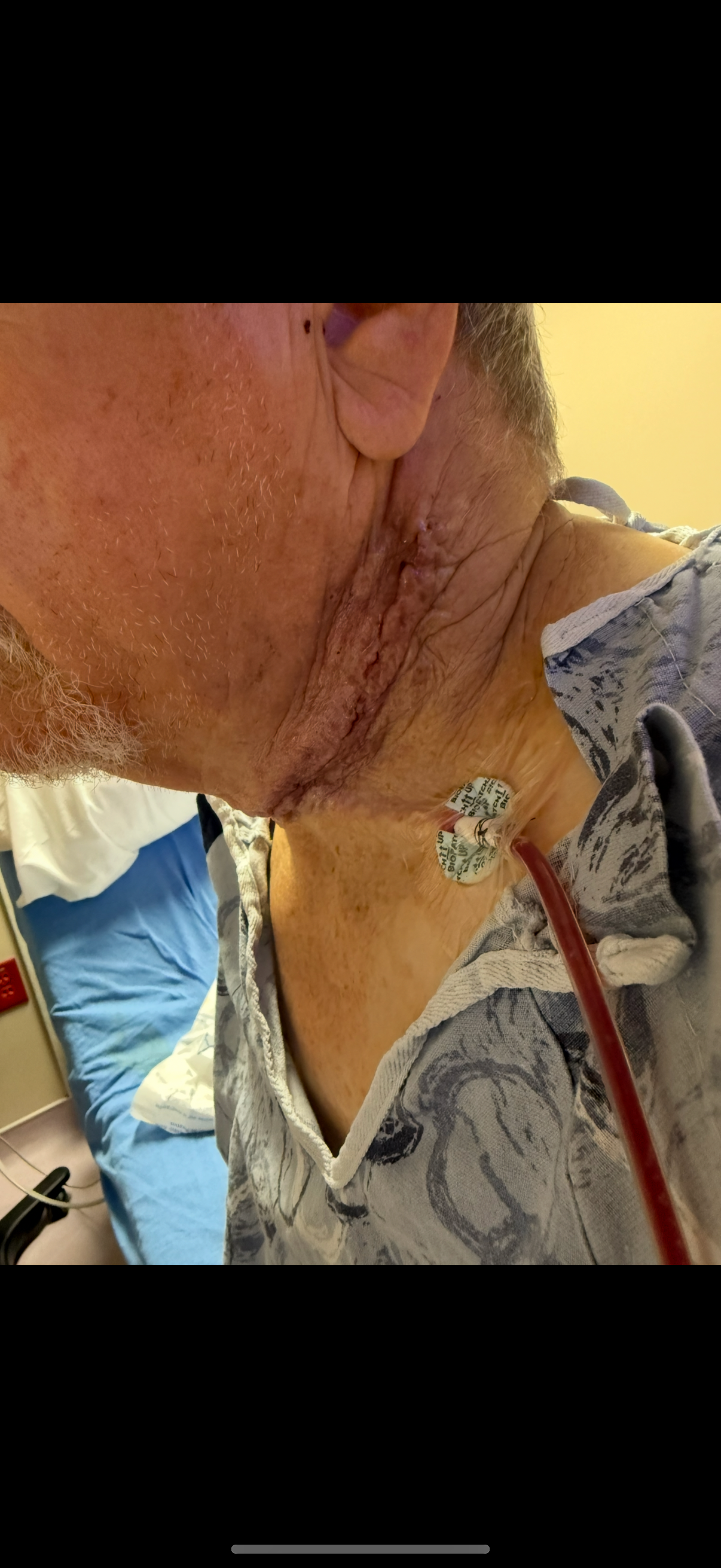 My Dad's Battle with Aggressive Throat Cancer - Please Share campaign photo, 7 of 8