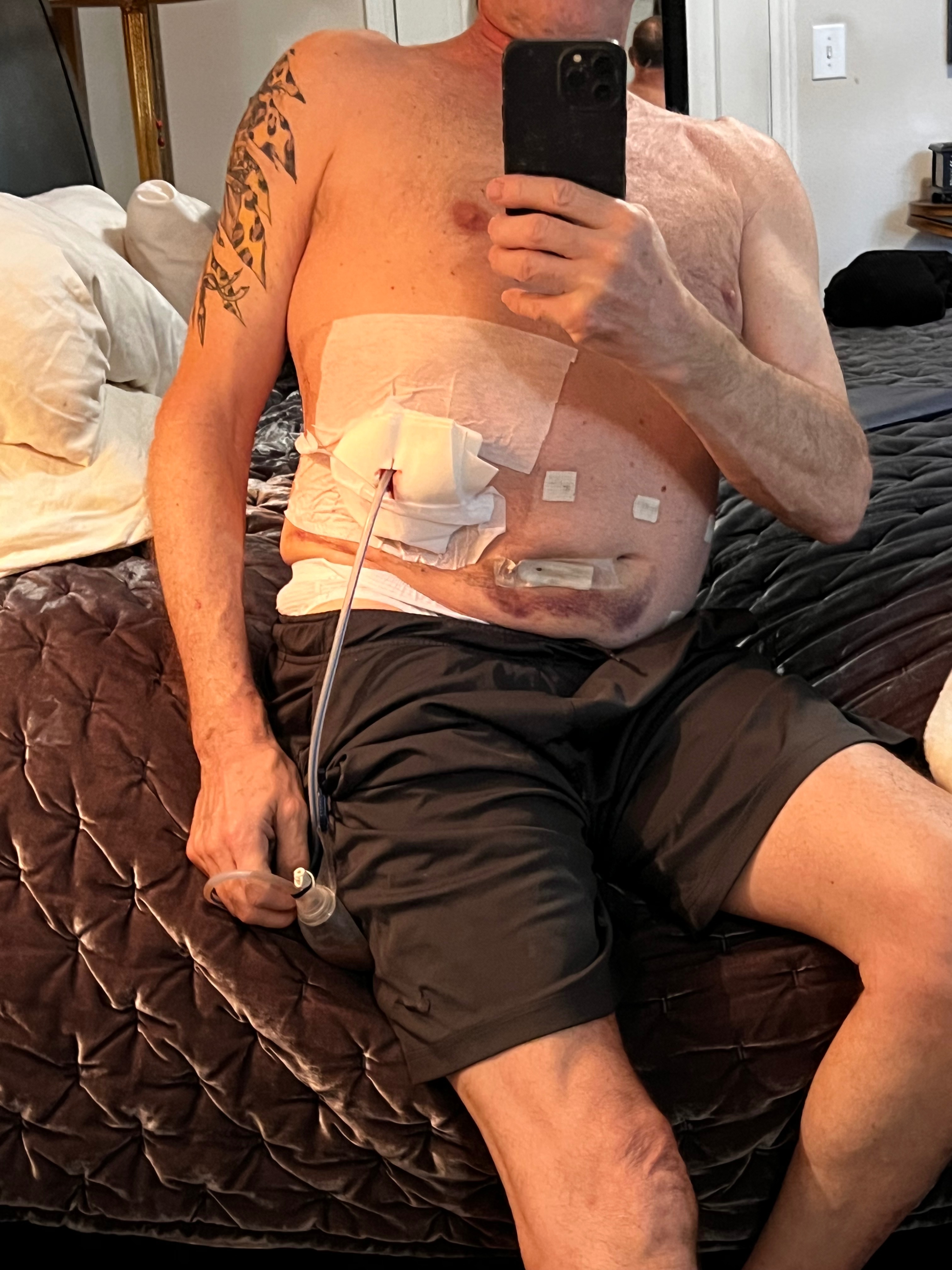 Donate - Help Tad in his battle against pancreas cancer campaign photo, 2 of 8