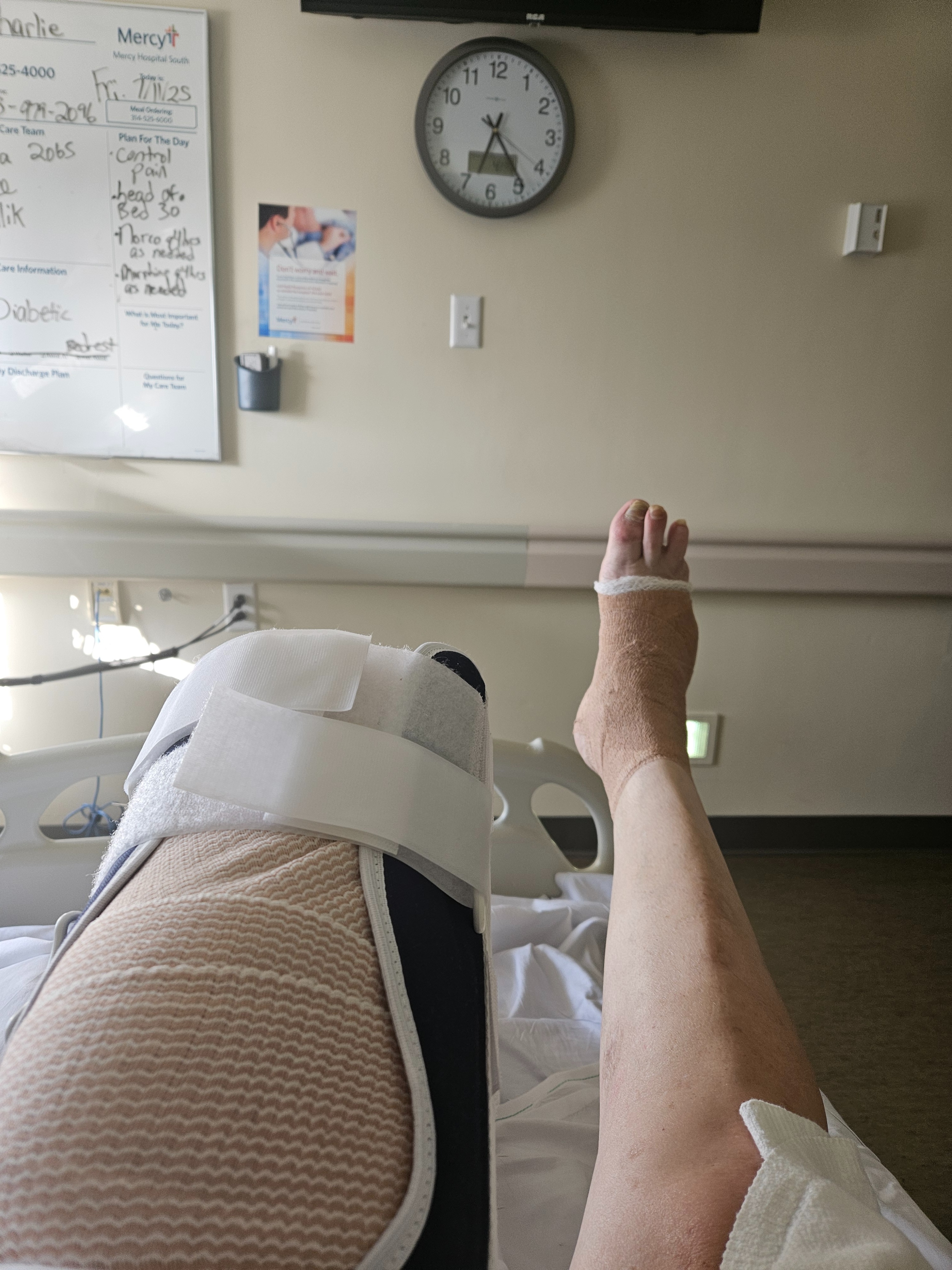 Support Charlie’s Recovery and a new leg . campaign photo, 2 of 5