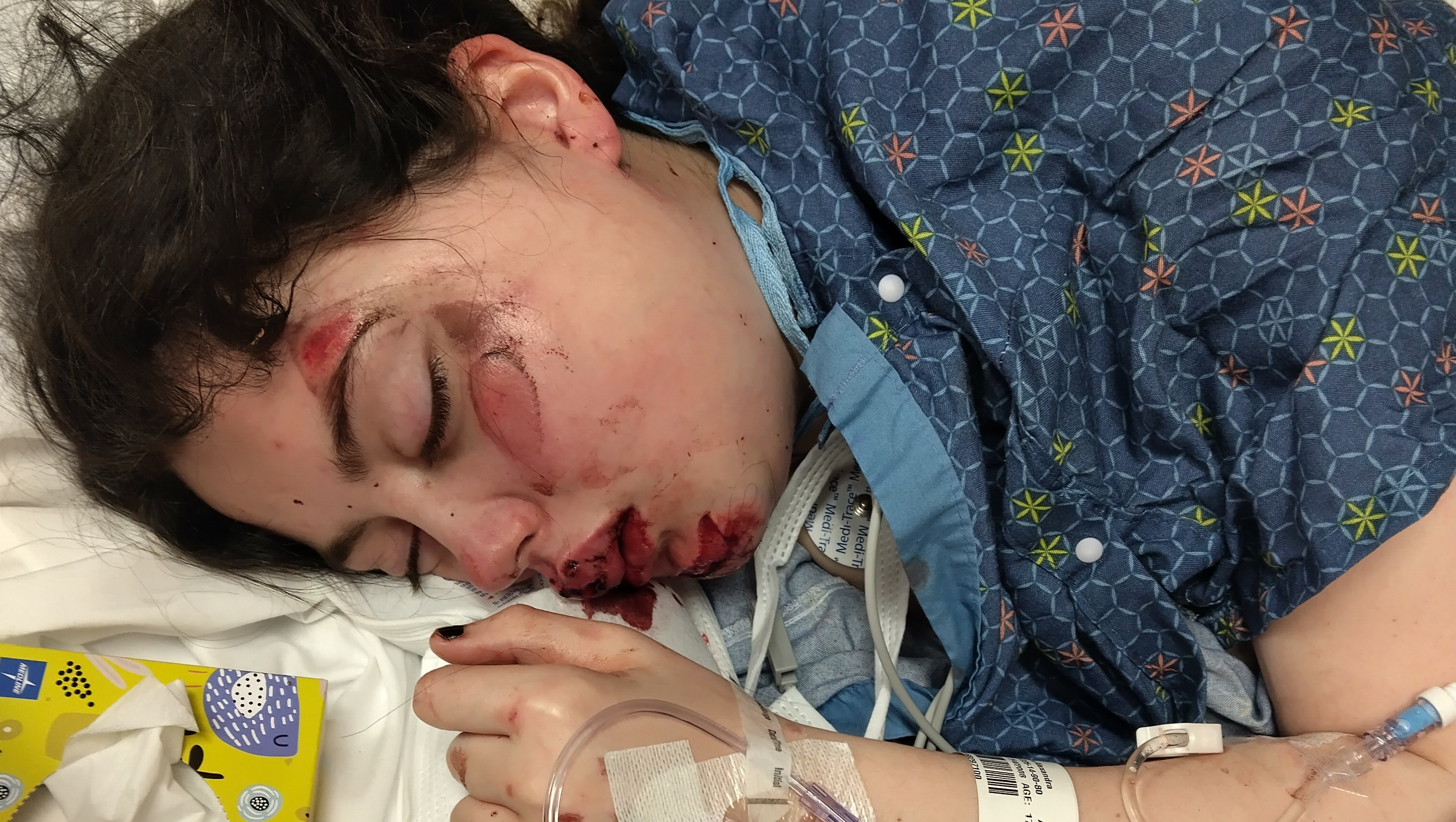 Help Alexandra Heal and Thrive photo