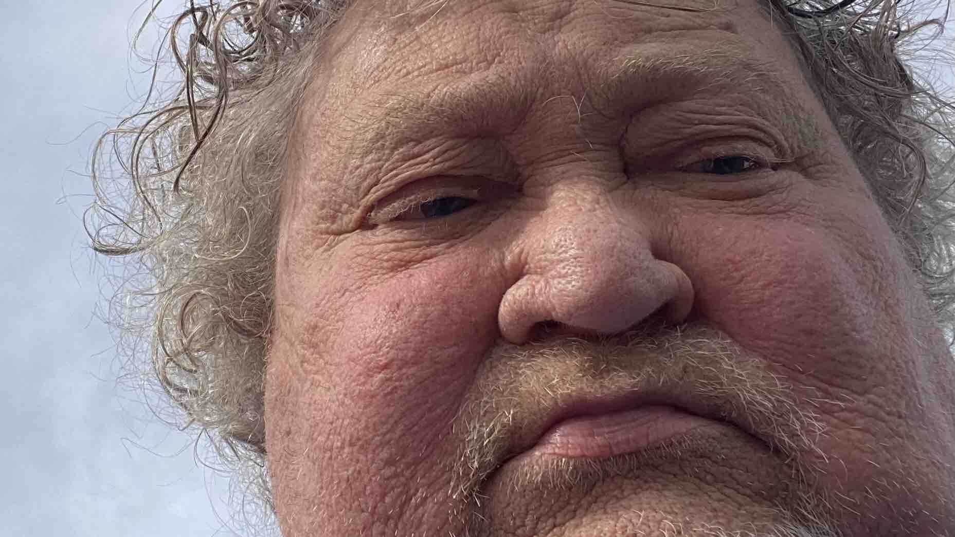 Wayne's Battle with multiple myeloma:Needs Your Support photo
