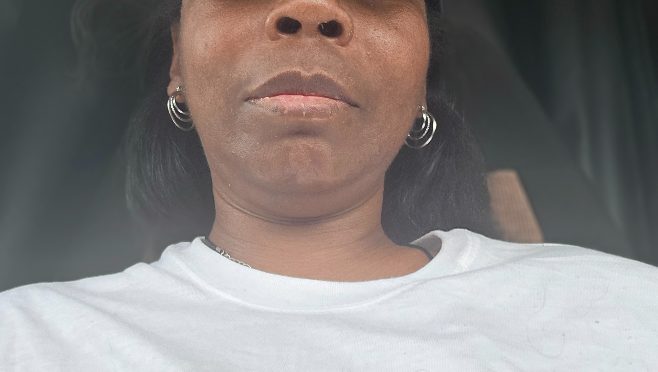 Help Restore Mobility After Misdiagnosis pinned link photo