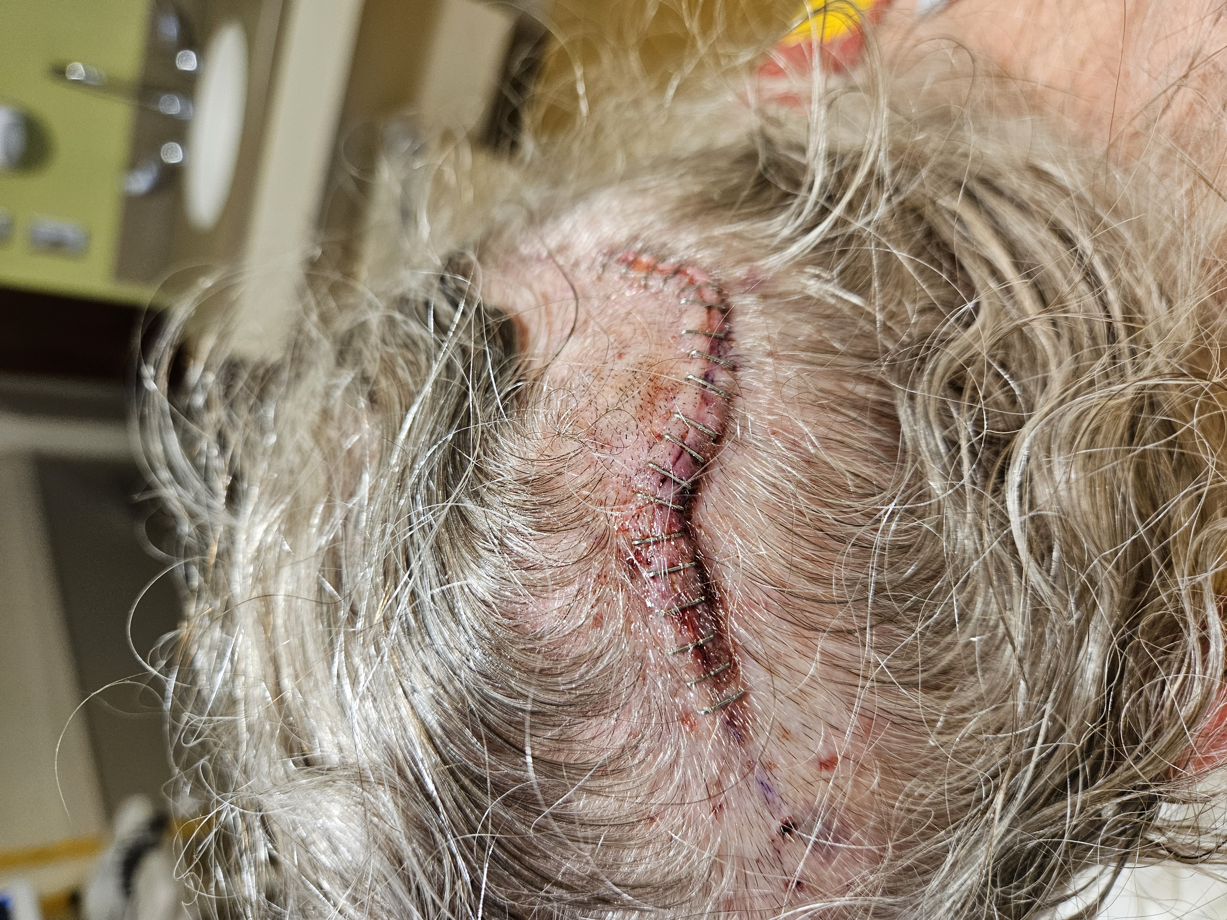Join Vikki's Fight Against Rare Fungal Brain Infection campaign photo, 4 of 8